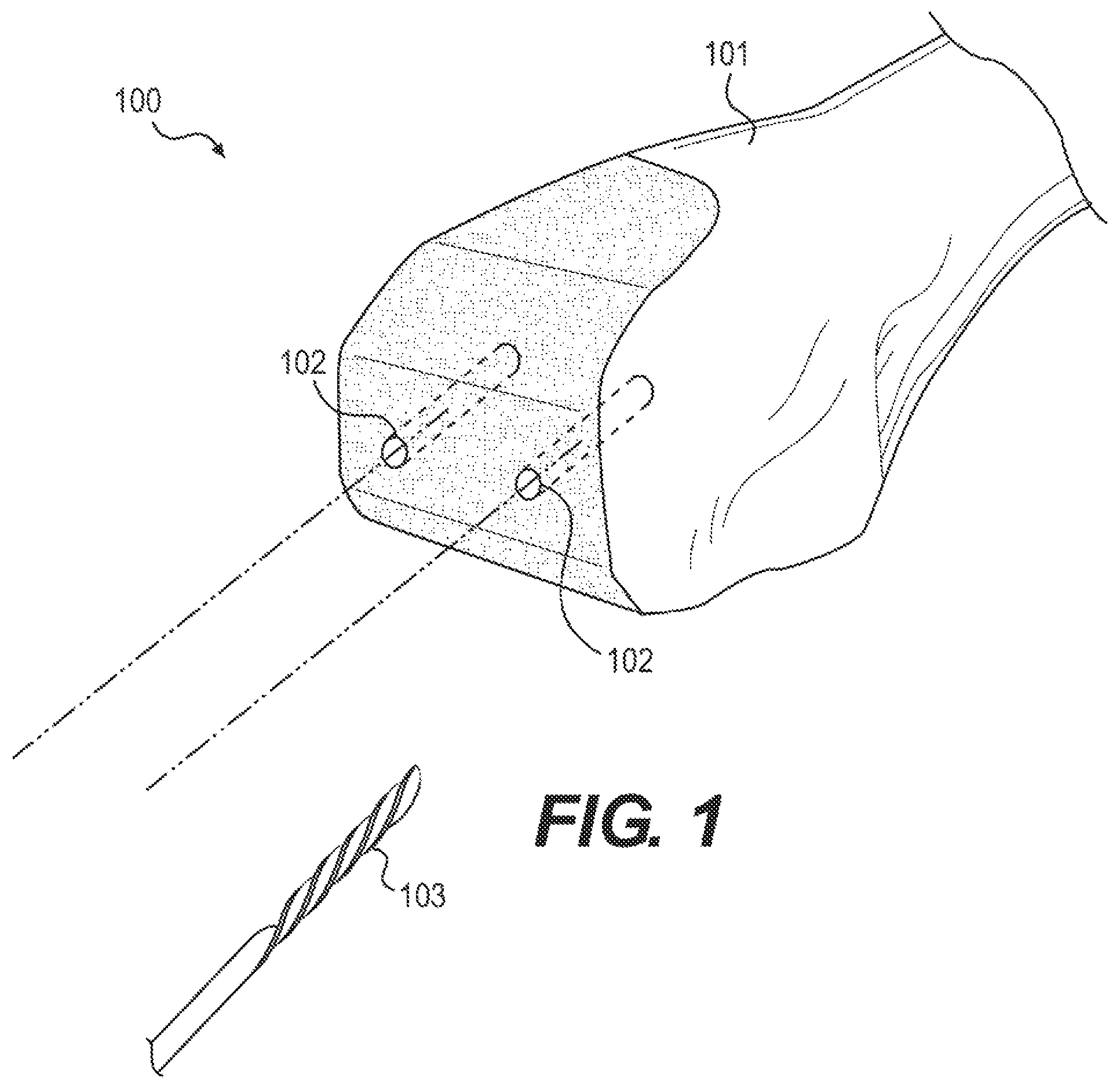 Patent US12611261 — Systems and methods for constrained surgical instrument alignment — Figure 1