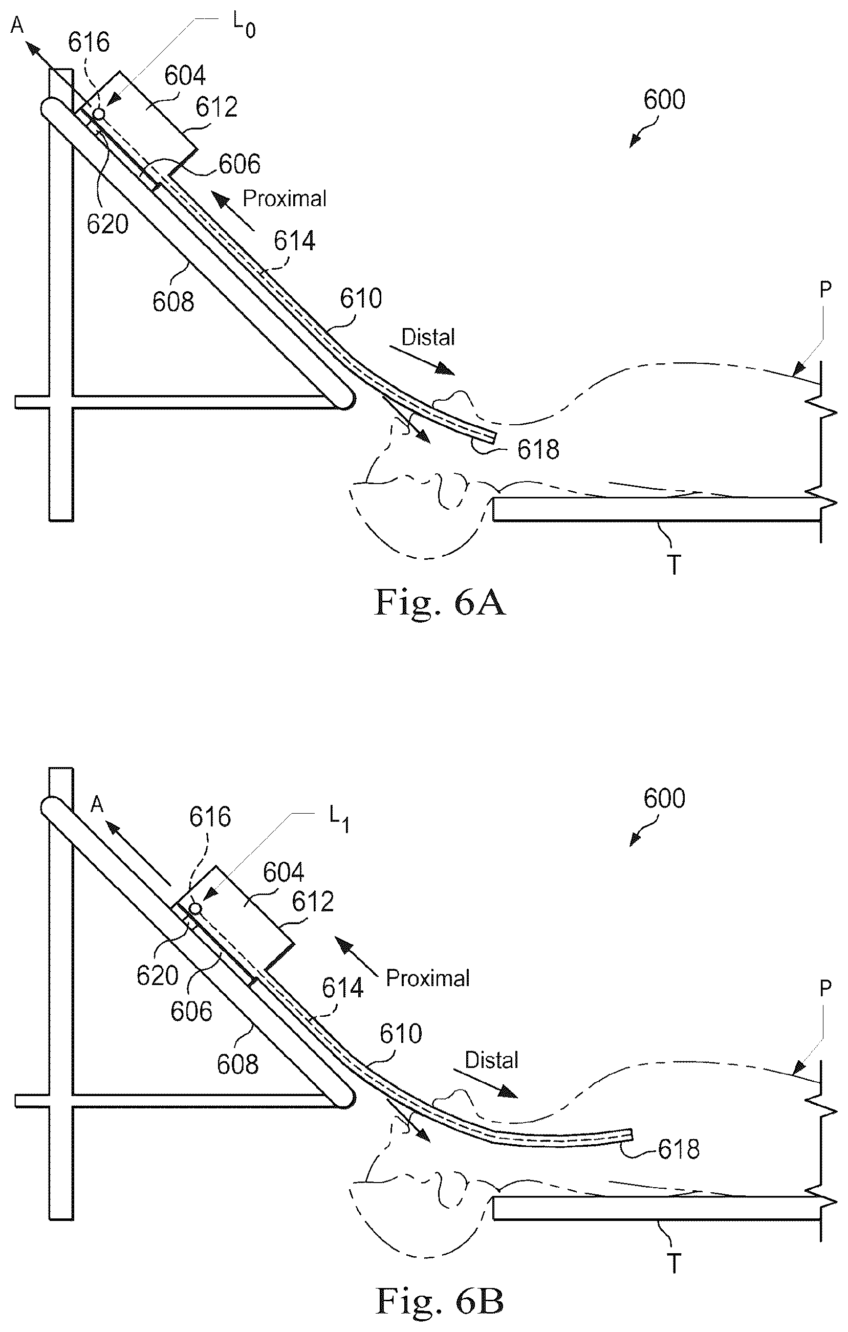 Patent US12611264 Figure 5 – Systems and methods of registration for image-guided procedures