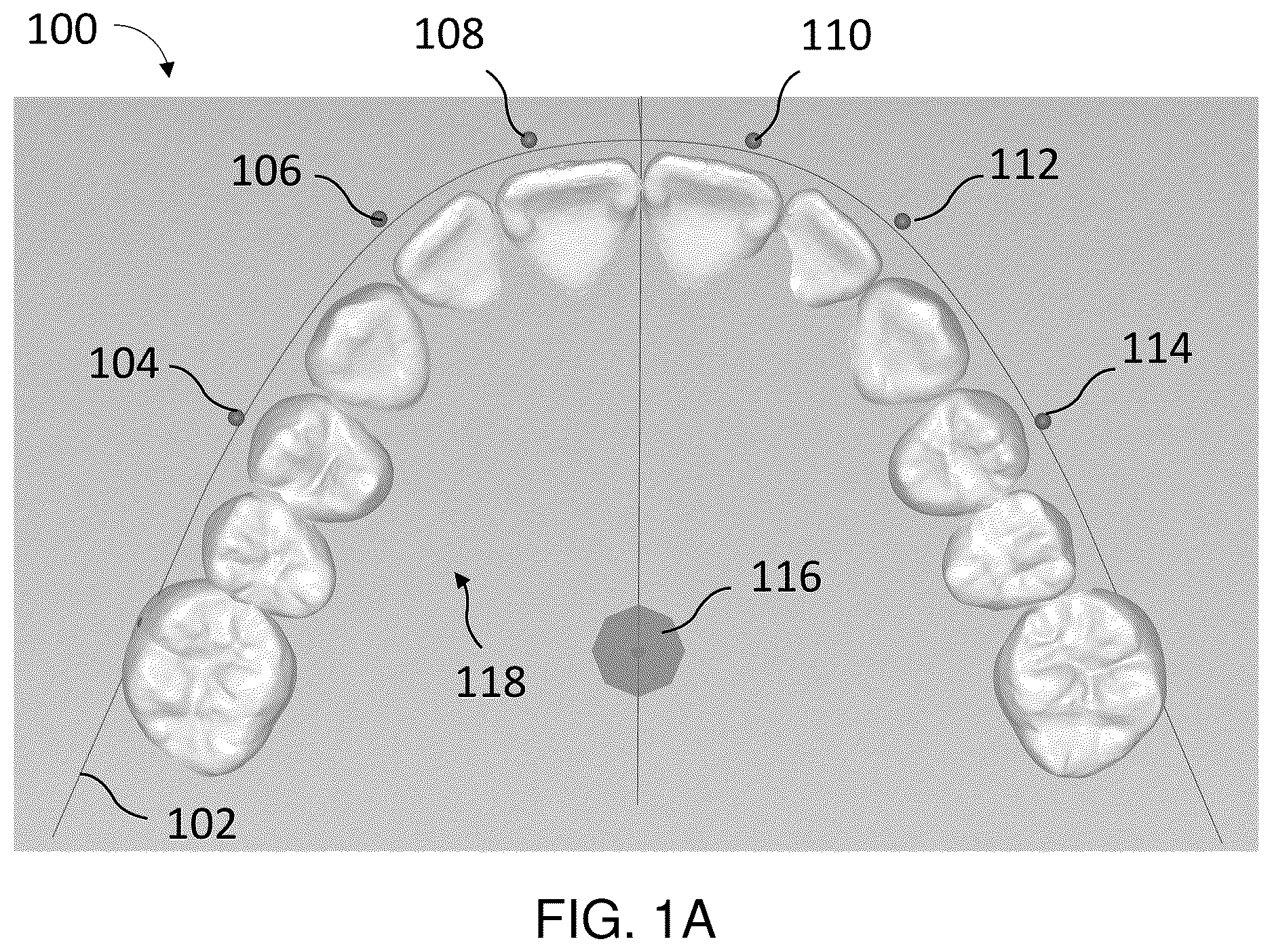 Patent US12611287 Figure 1 – Techniques for determining patient teeth positions for orthodontics