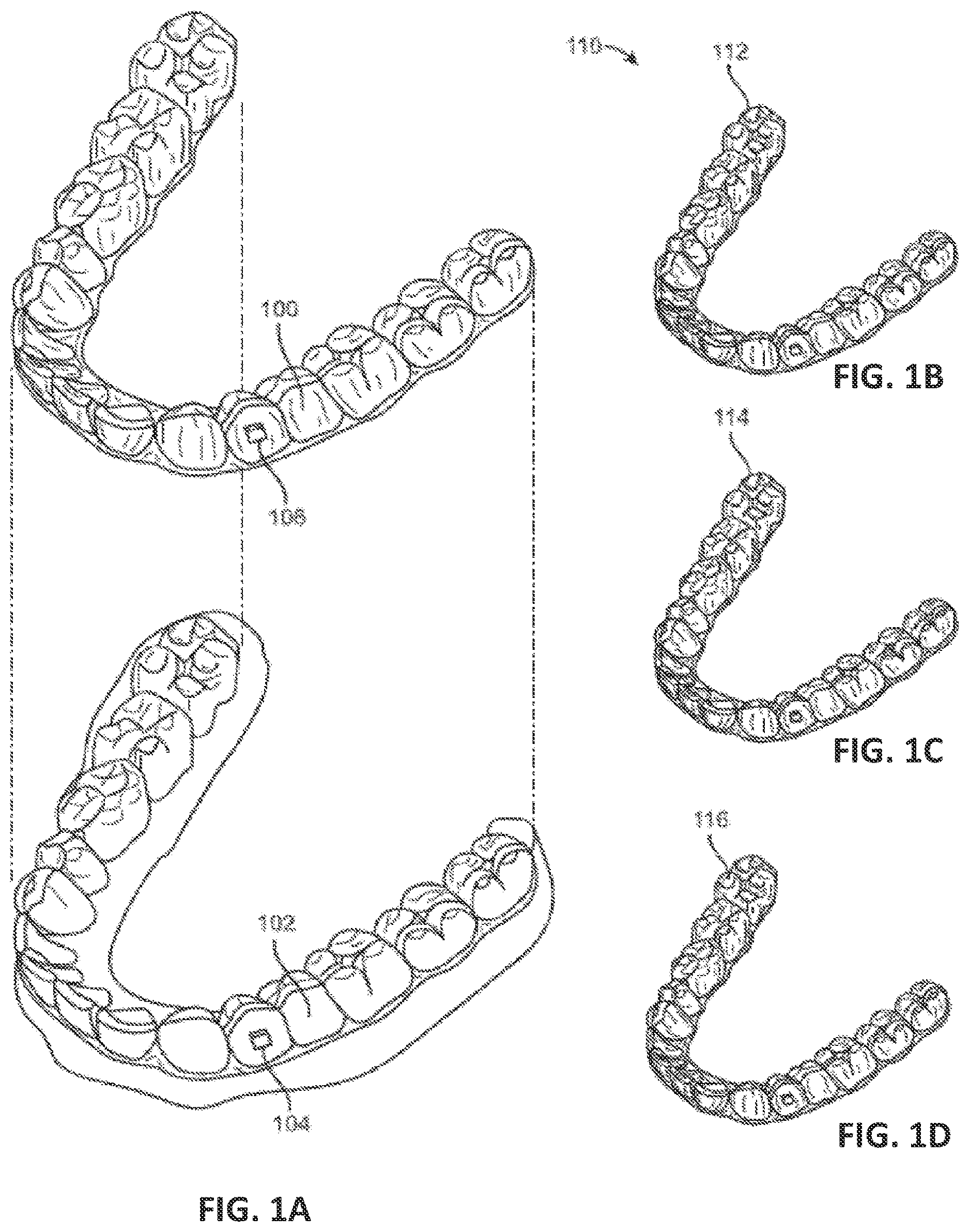 Patent US12611291 — Biosensor performance indicator systems for orthodontic appliances — Figure 1
