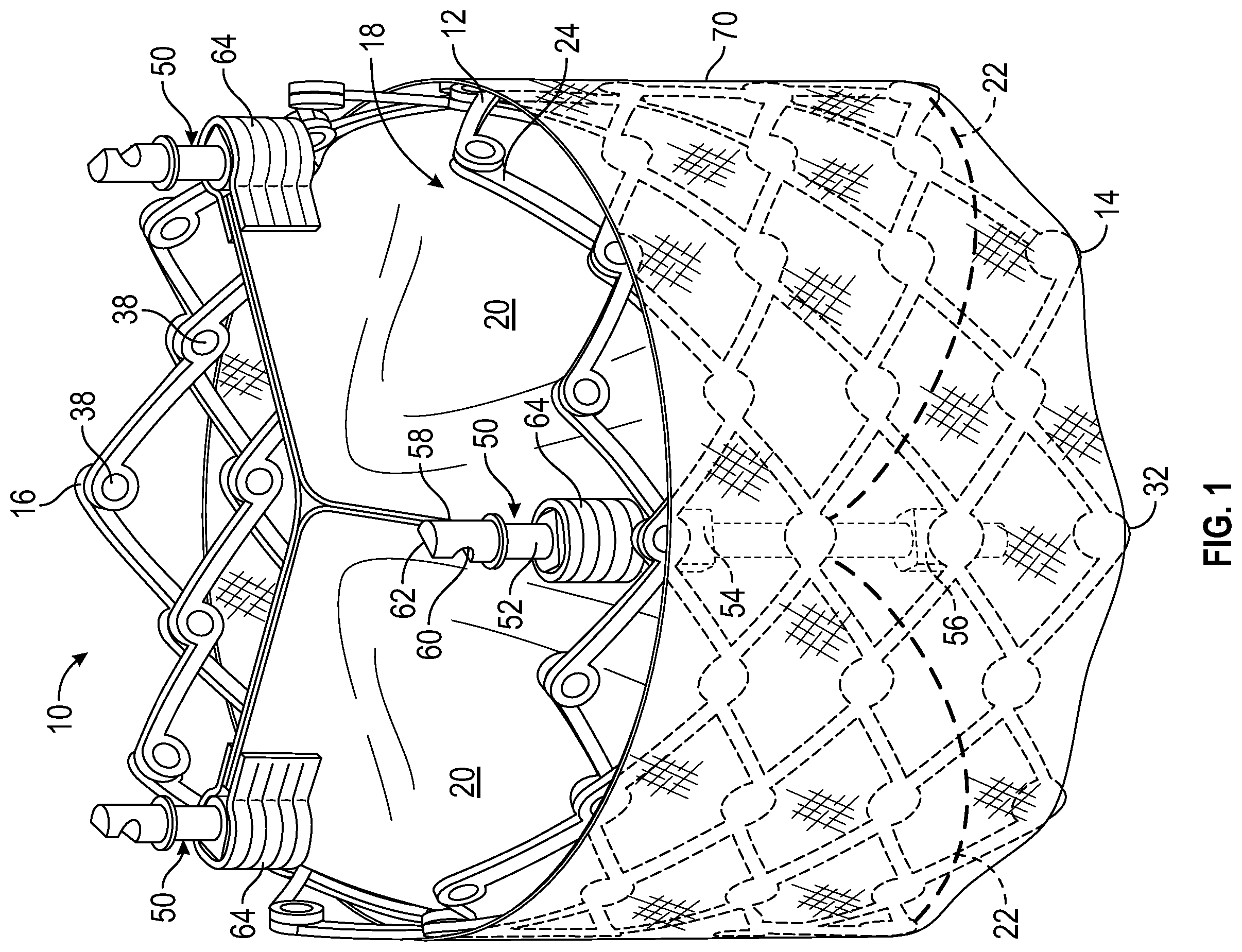 Patent US12611301 — Commissure locking member — Figure 1