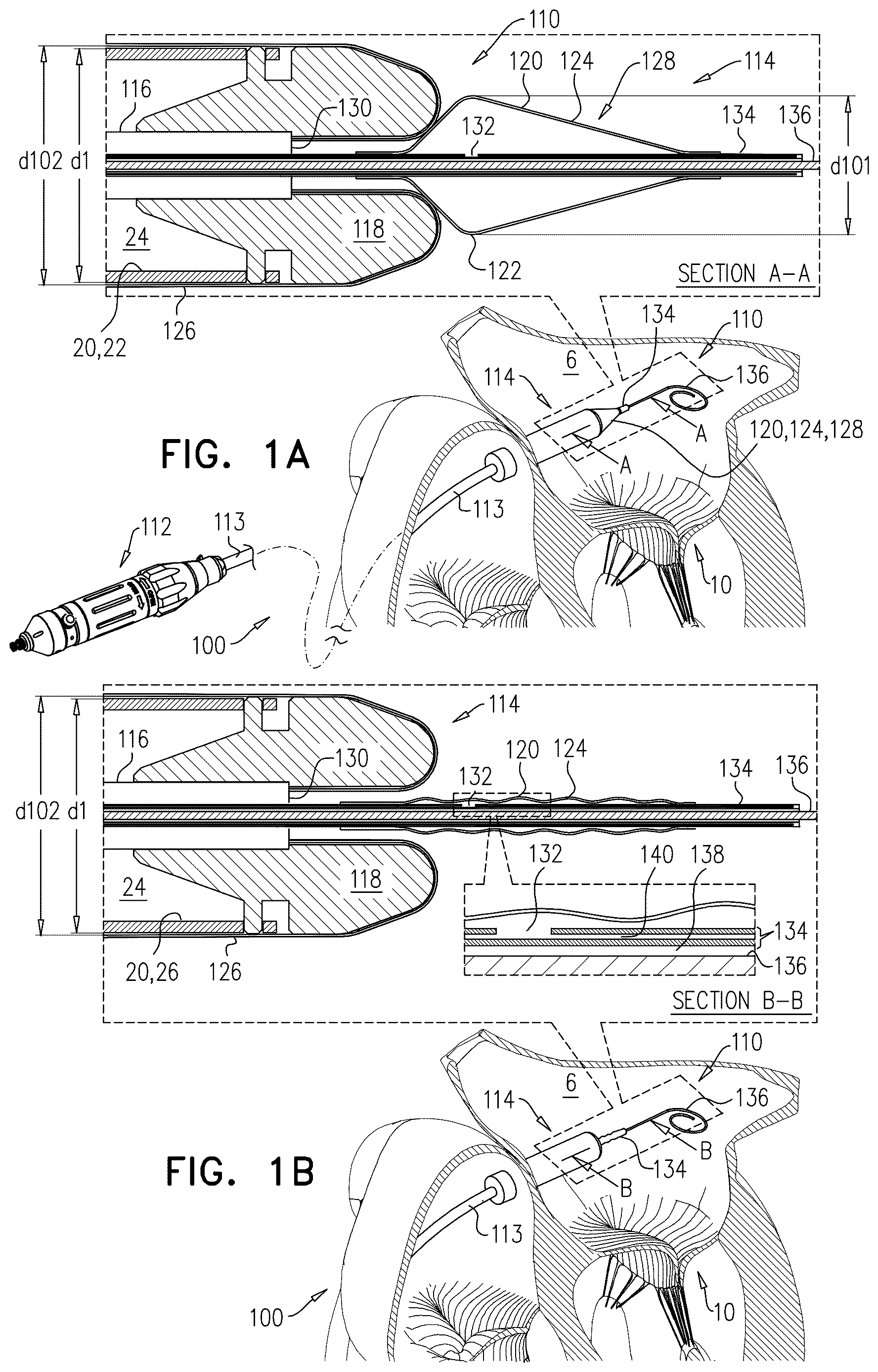 Patent US12611305 Figure 1 – Minimally-invasive delivery systems