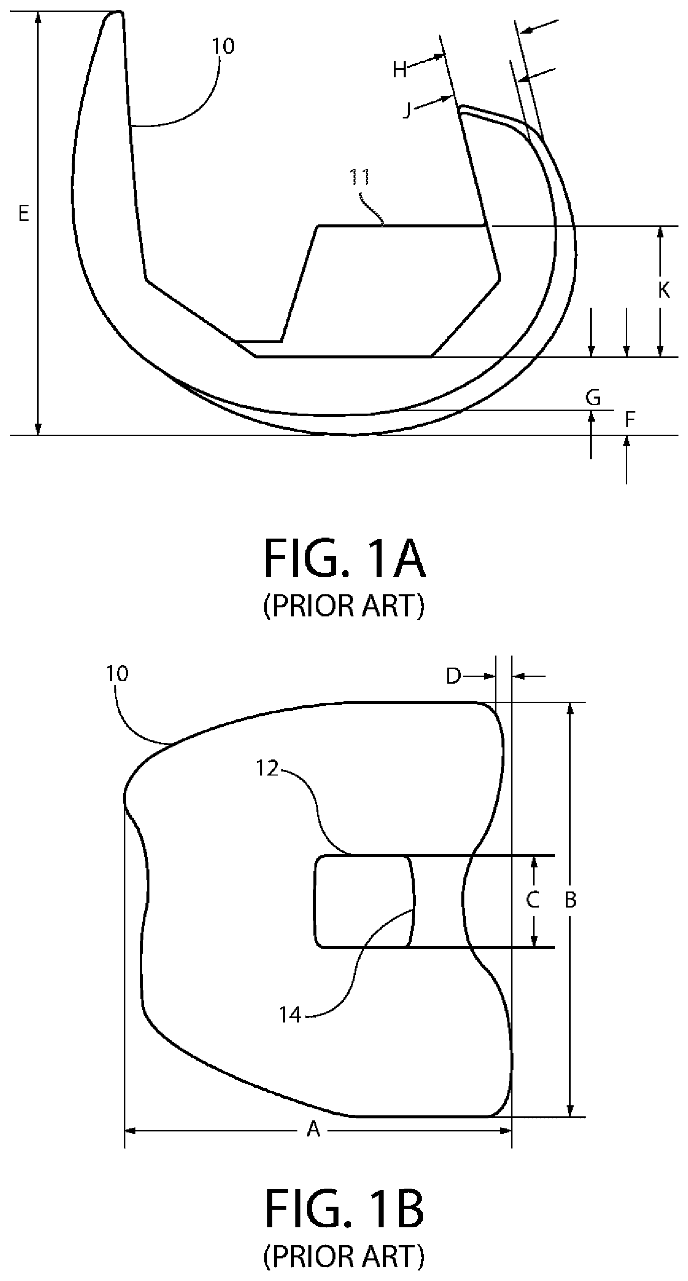 Patent US12611310 Figure 1 – Modular artificial knee system