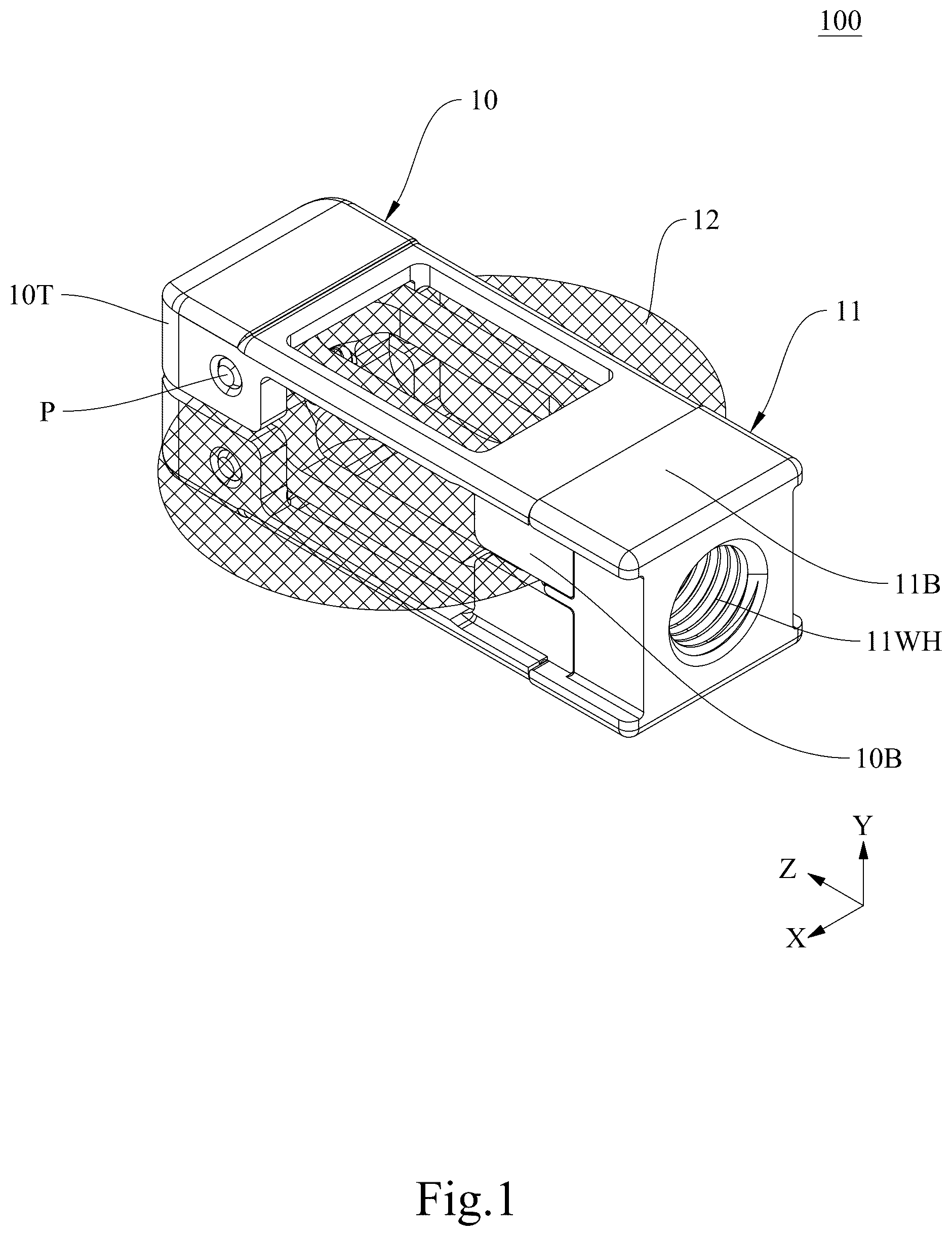Patent US12611314 — Intervertebral implant and device and system comprising the same — Figure 1