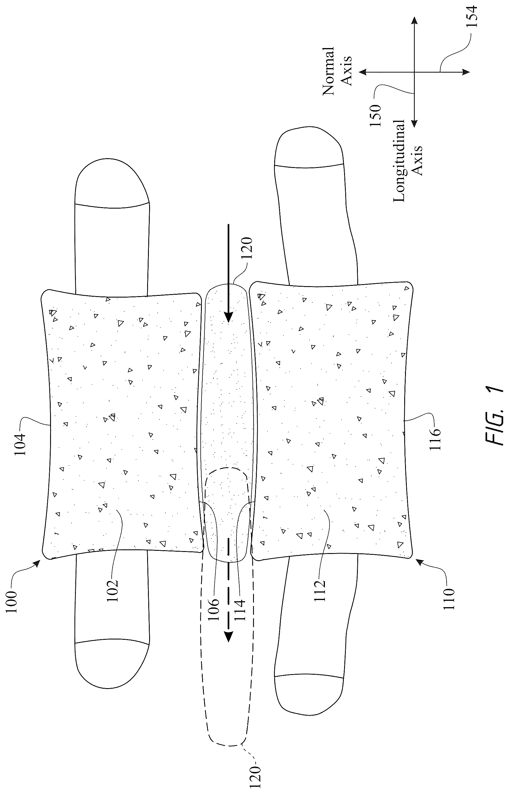 Patent US12611316 Figure 1 – Intervertebral members and methods of using a bone reinforcing composition for retaining the intervertebral members