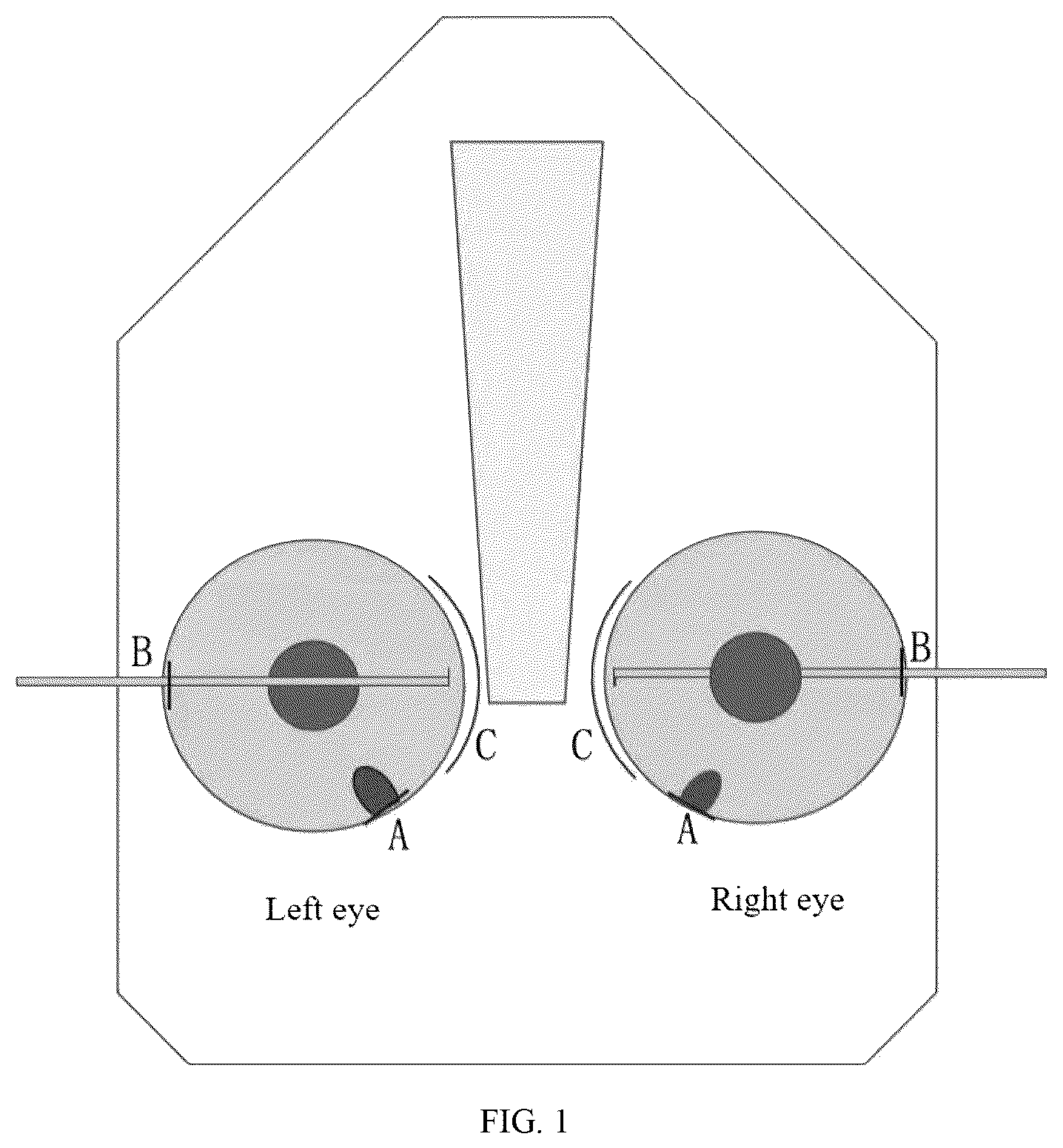 Patent US12611331 — Method for treating advanced primary angle closure glaucoma — Figure 1