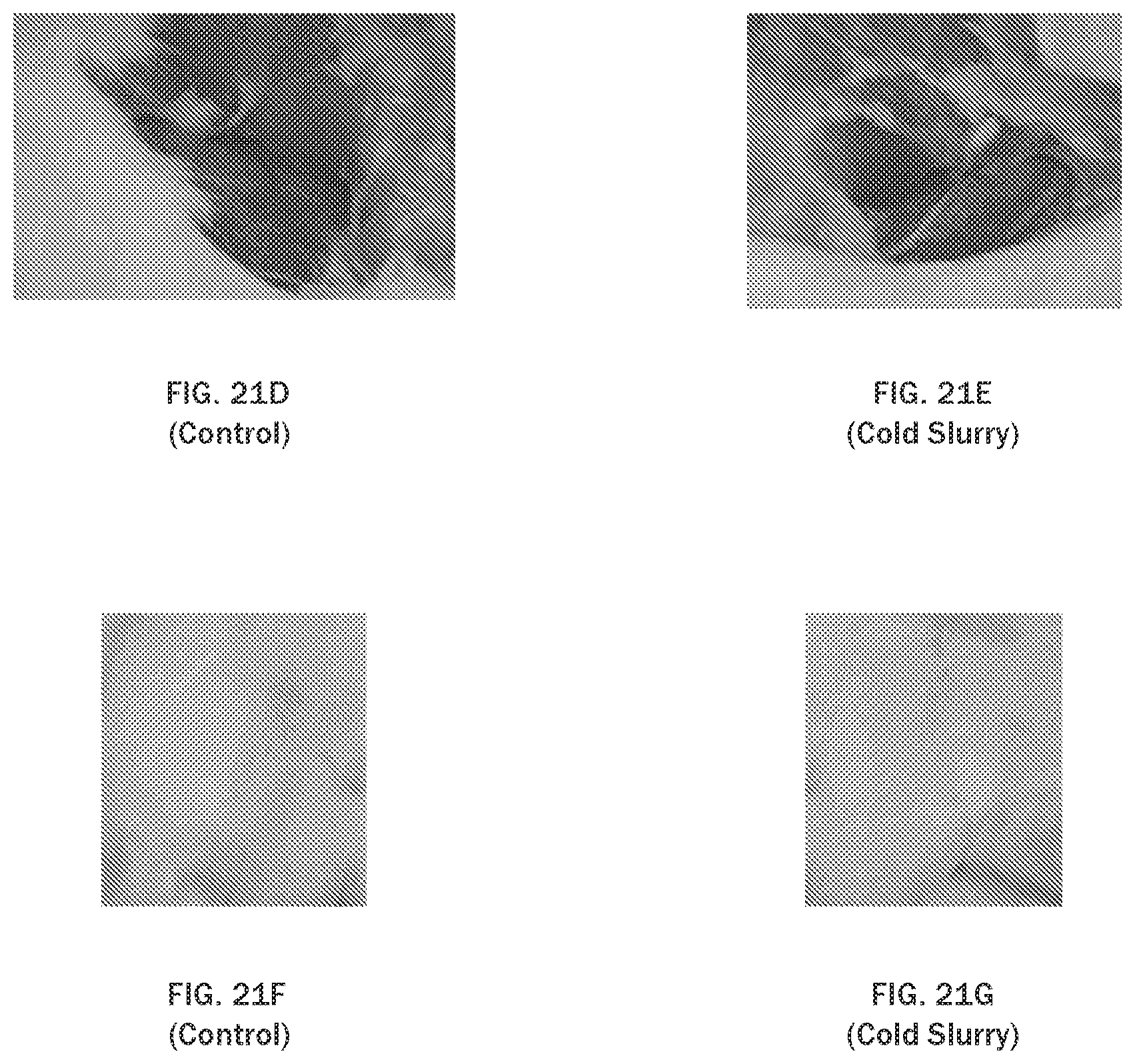 Patent US12611375 Figure 20 – Injectable slurries and methods of manufacturing the same