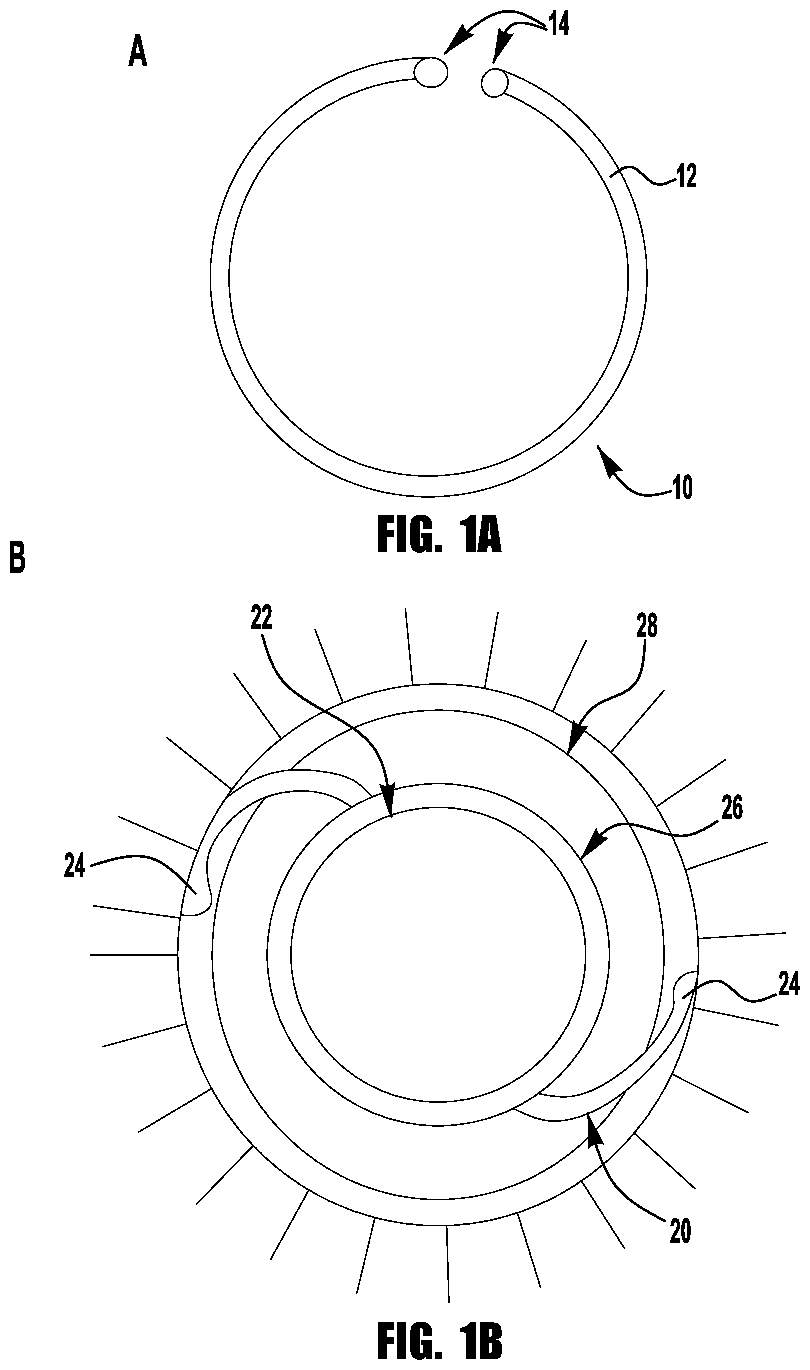 Patent US12611376 — Drug delivering stretch ring — Figure 1