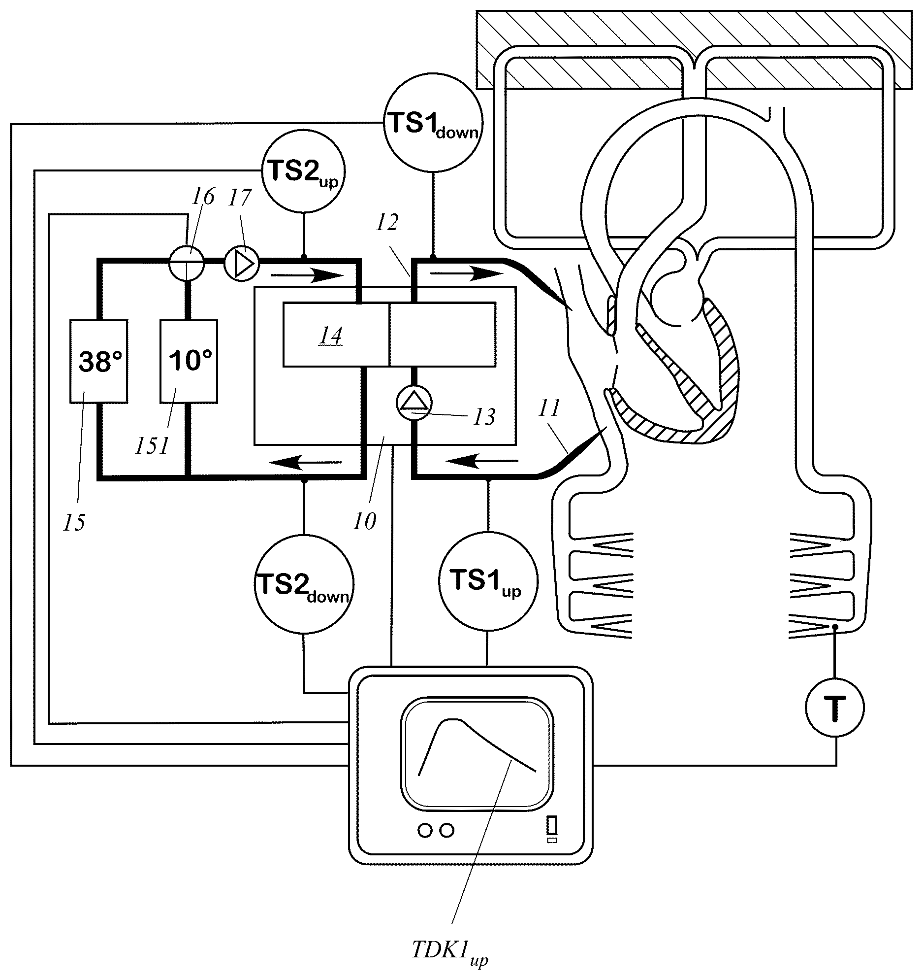 Patent US12611493 — Extracorporeal blood treatment device with function-monitoring system — Figure 1