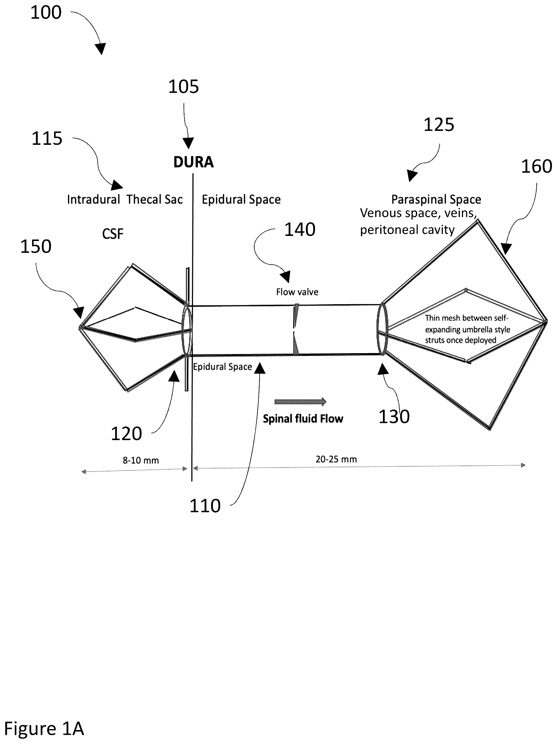 Patent US12611528 — Systems and methods for draining cerebrospinal fluid — Figure 1