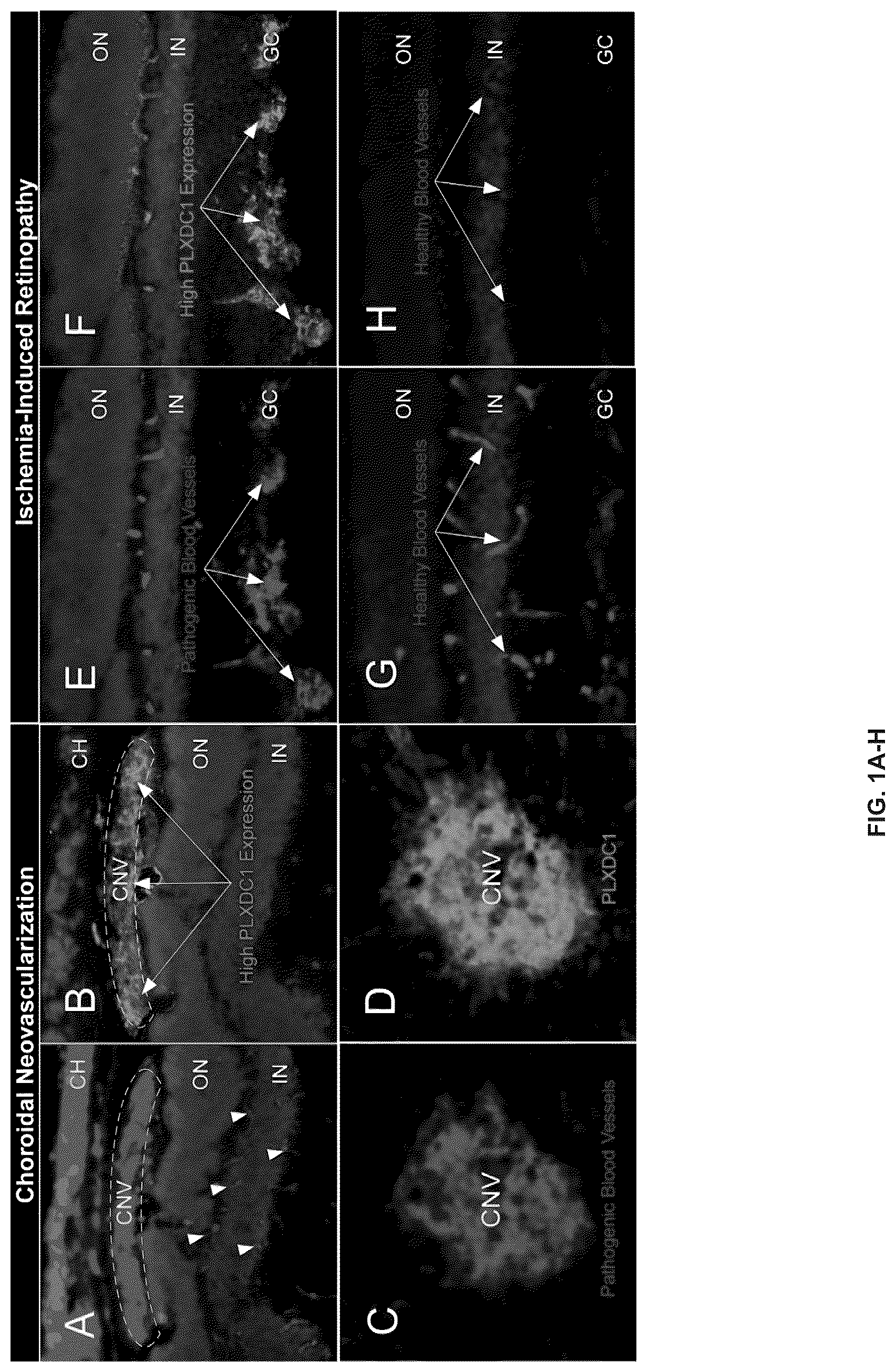 Patent US12612385 — Compounds and methods for targeting pathogenic blood vessels — Figure 1