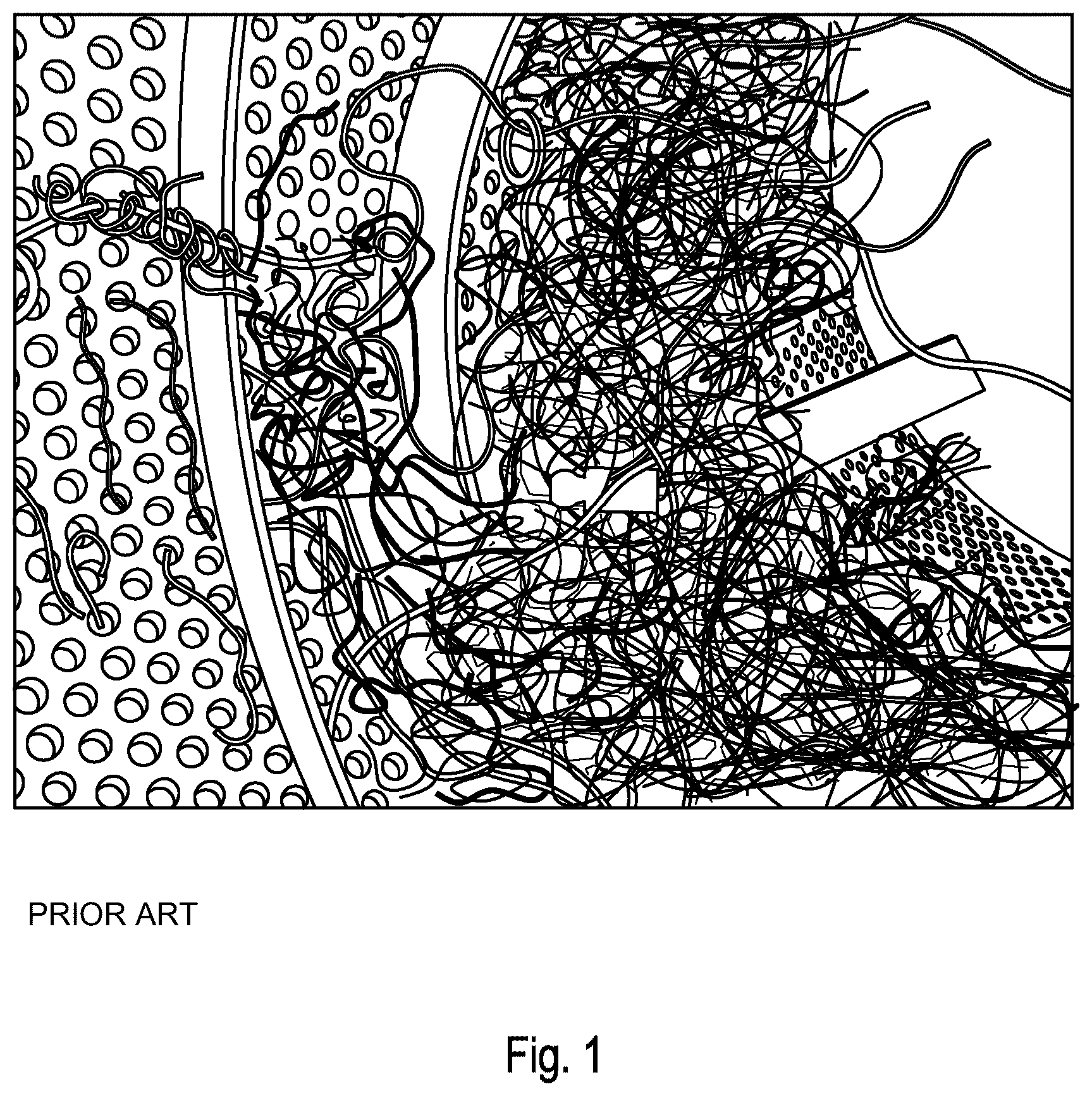 Patent US12613029 — Device and method for sorting a particulate stream — Figure 1