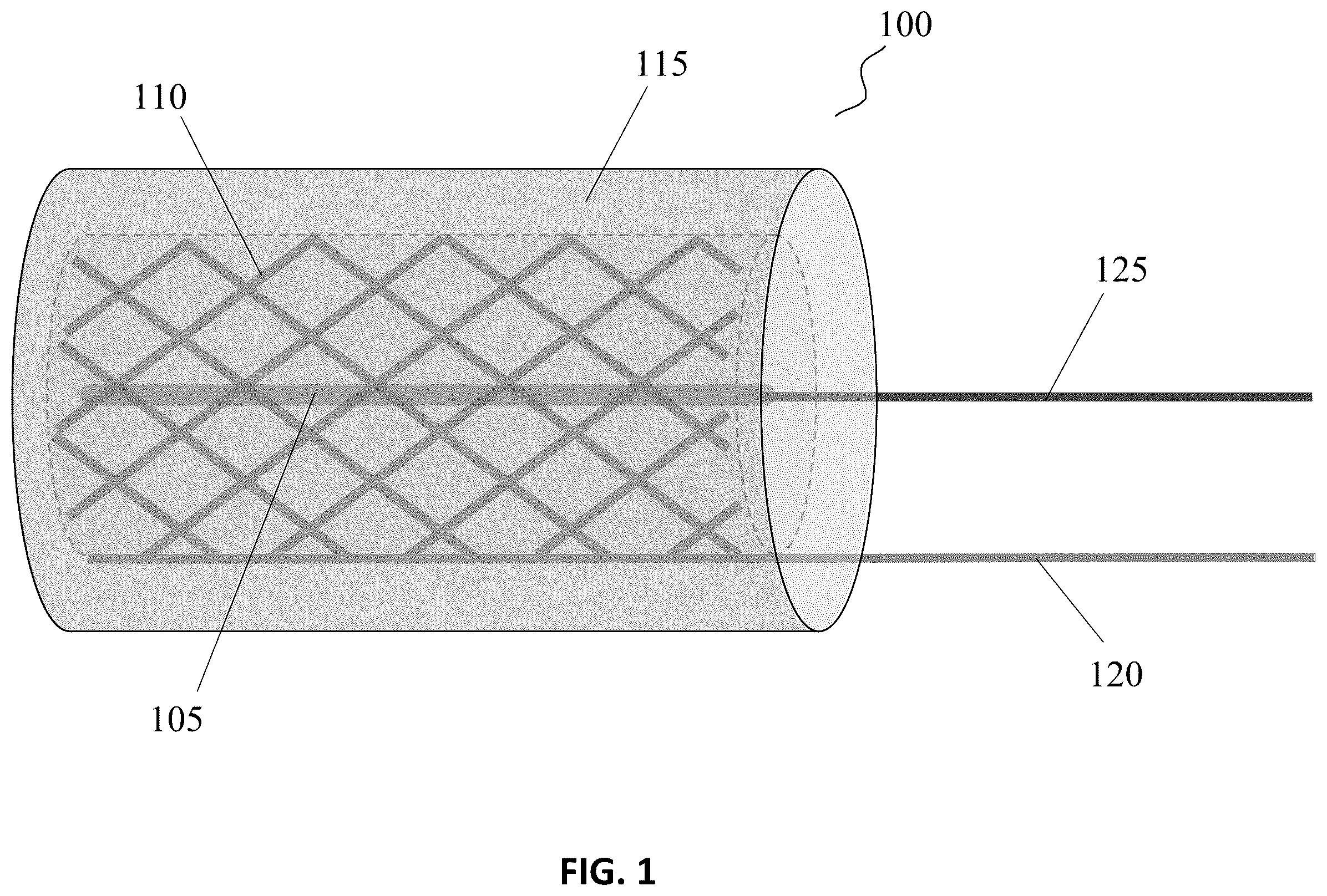 Patent US12613209 Figure 1 – Embedded sensor system for measurement and monitoring of the pore solution electrical resistivity in concrete materials and structures