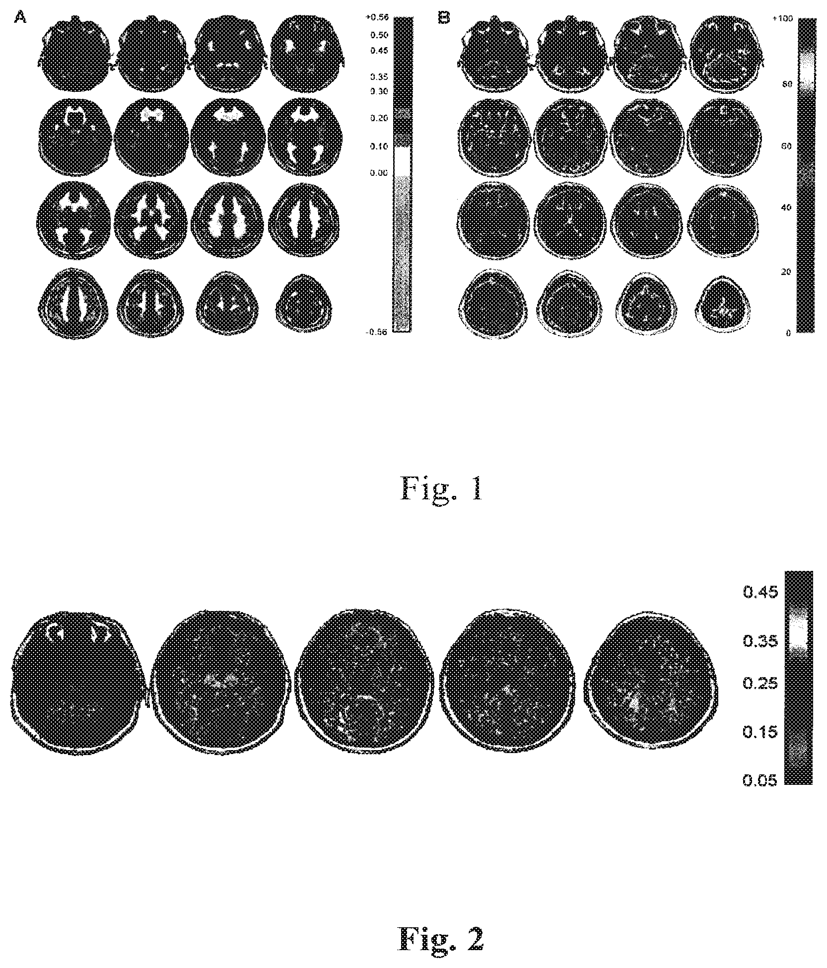 Patent US12614292 — Imaging abnormalities in vascular response — Figure 1
