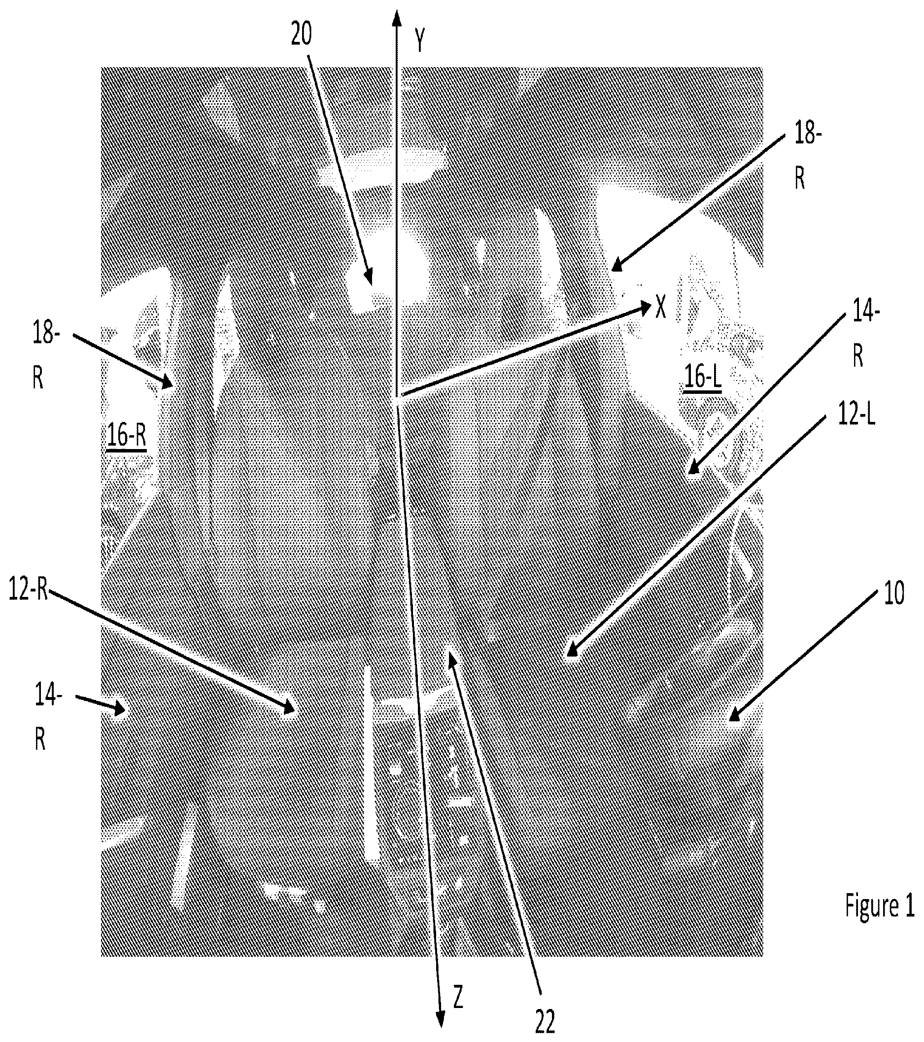 Patent US12614310 — Method for calibrating a vehicle cabin camera — Figure 1