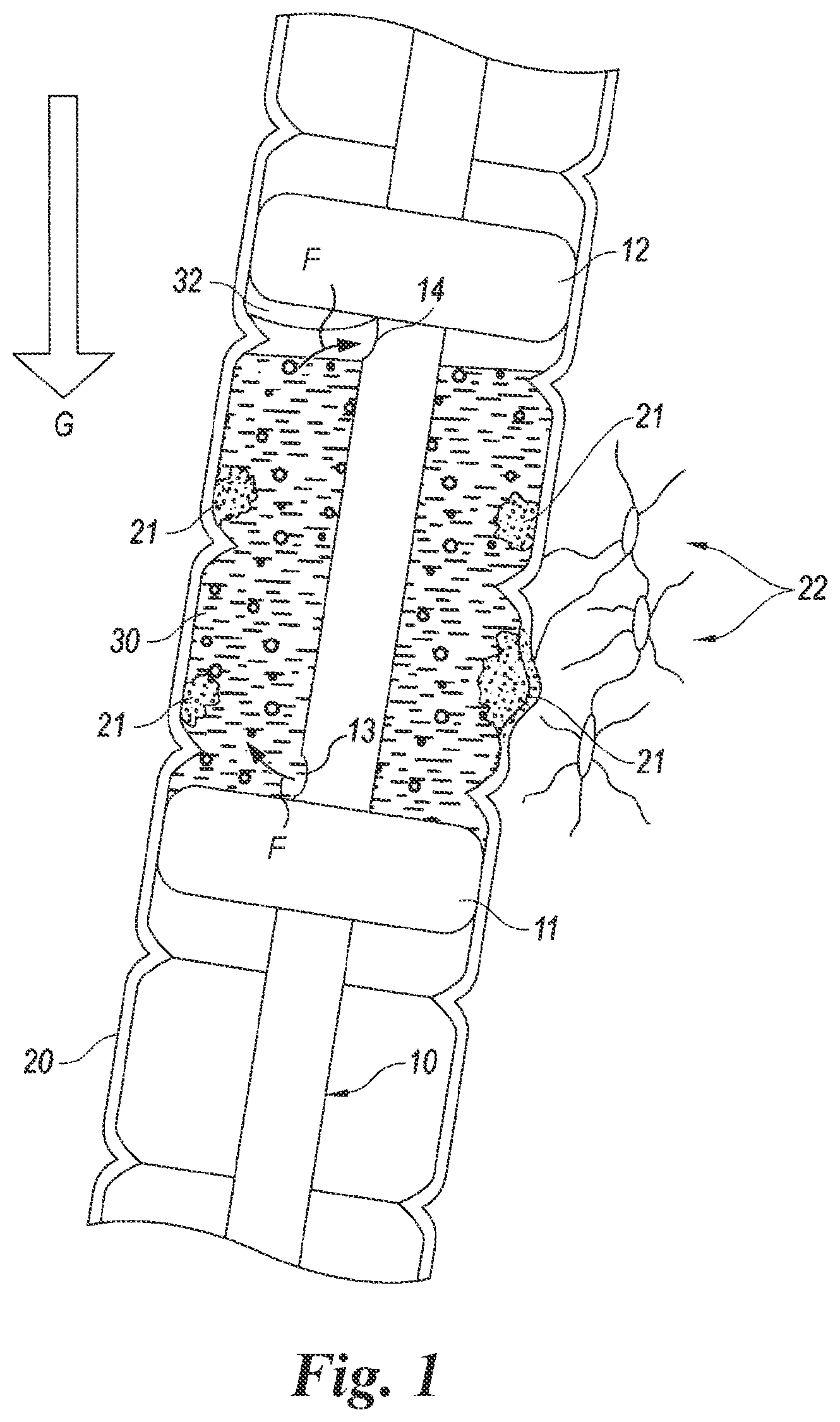 Patent US12614623 — Planning and navigation in superselective drug delivery via the tracheobronchial airway — Figure 1