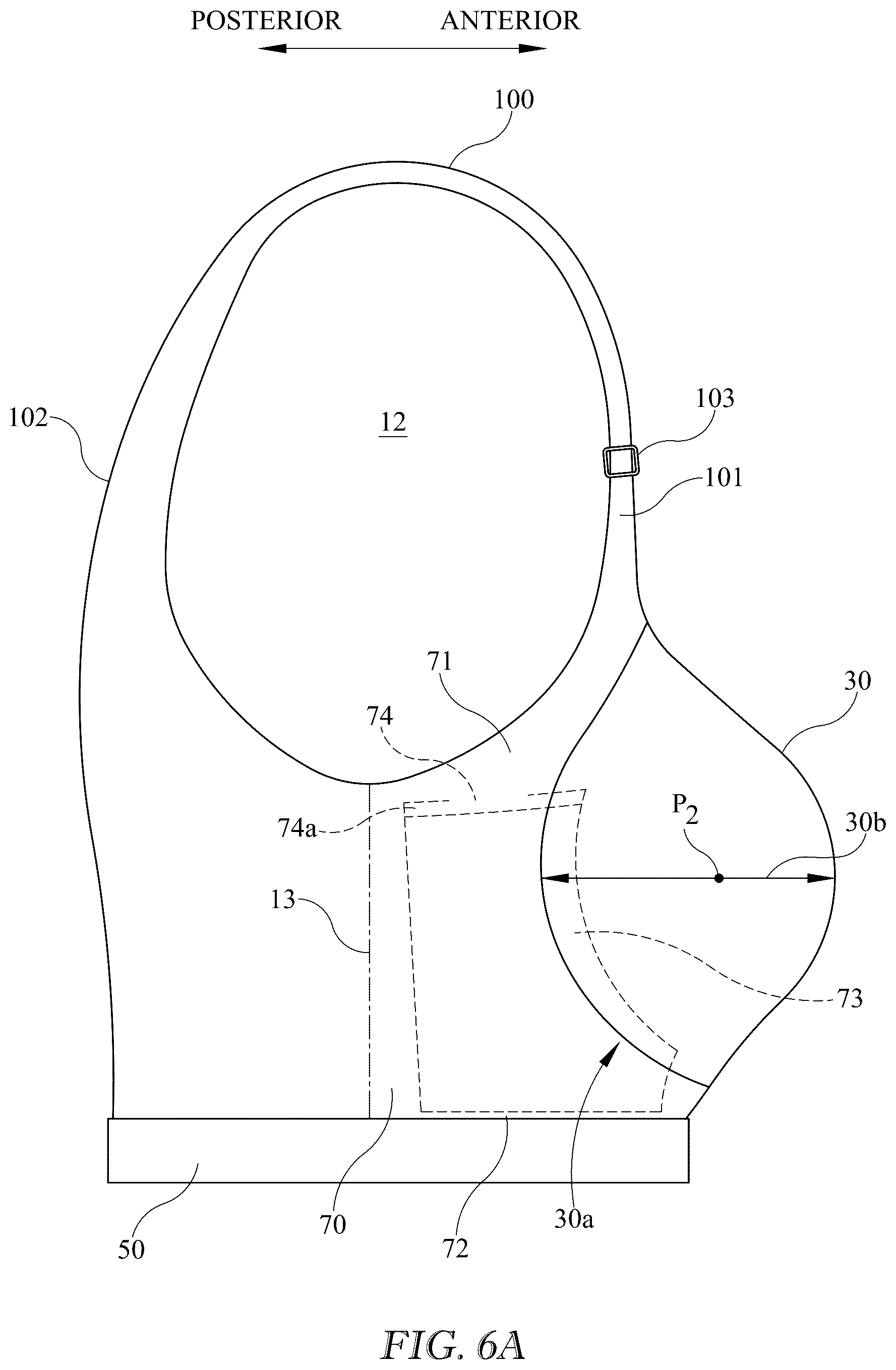 Patent US12616256 Figure 7 – Breast support garment