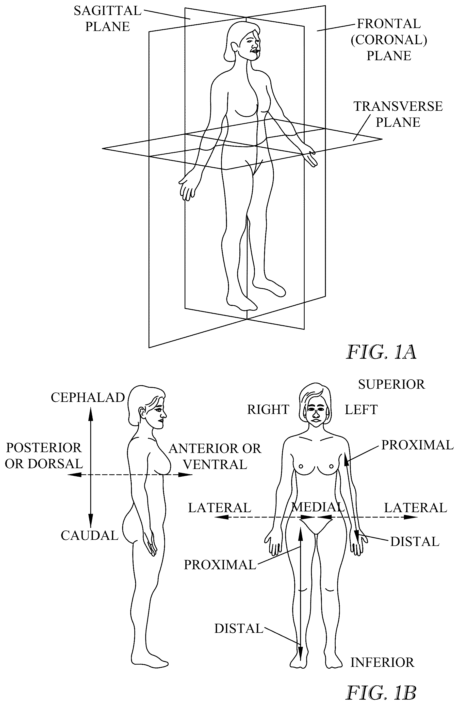 Patent US12616257 — Breast support garment — Figure 1