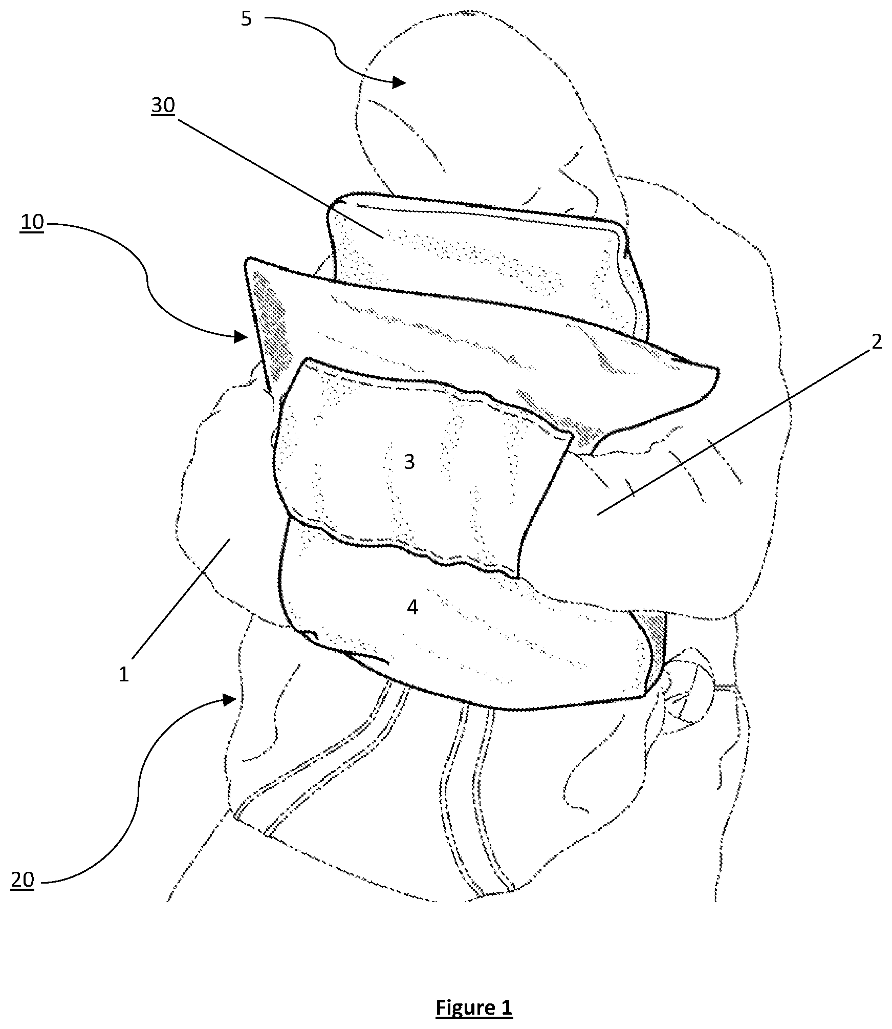 Patent US12616309 — Apparatus for use with portable head support — Figure 1