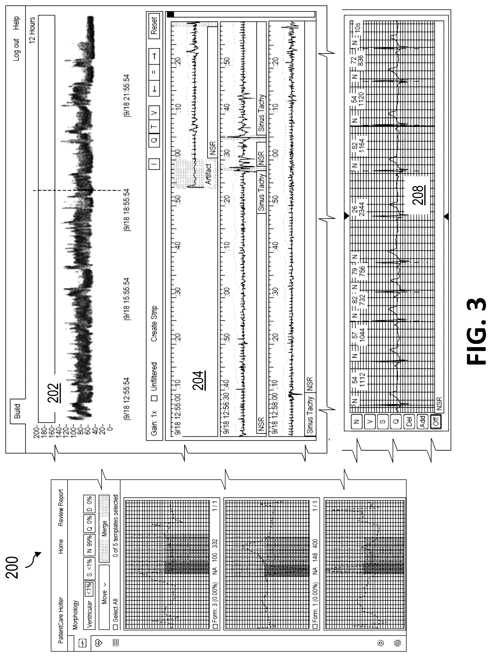 Patent US12616368 Figure 3 – Beat reclassification