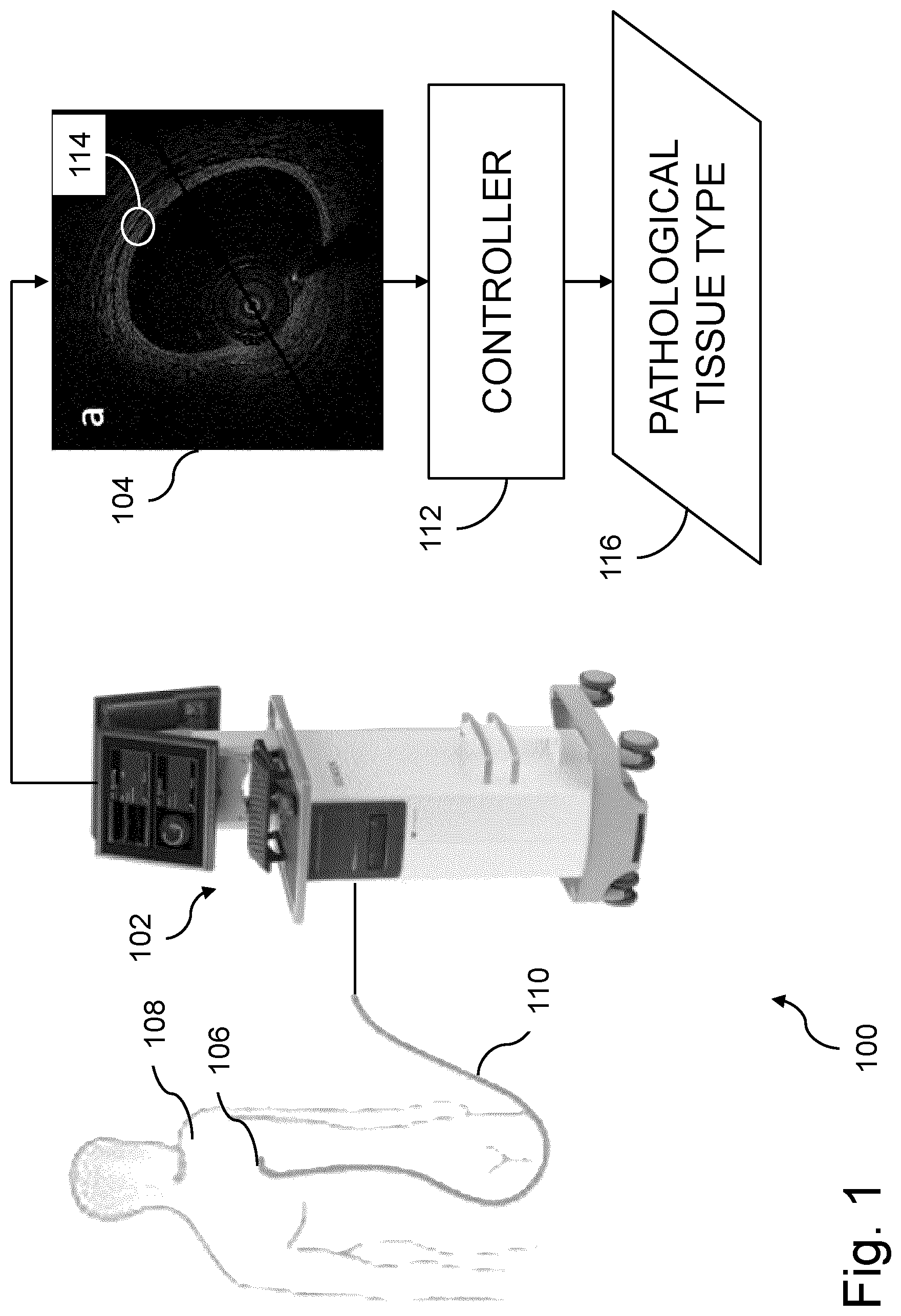 Patent US12616370 — System and method for determining atherosclerotic pathological tissue types in a coronary artery OCT image using trained engines — Figure 1