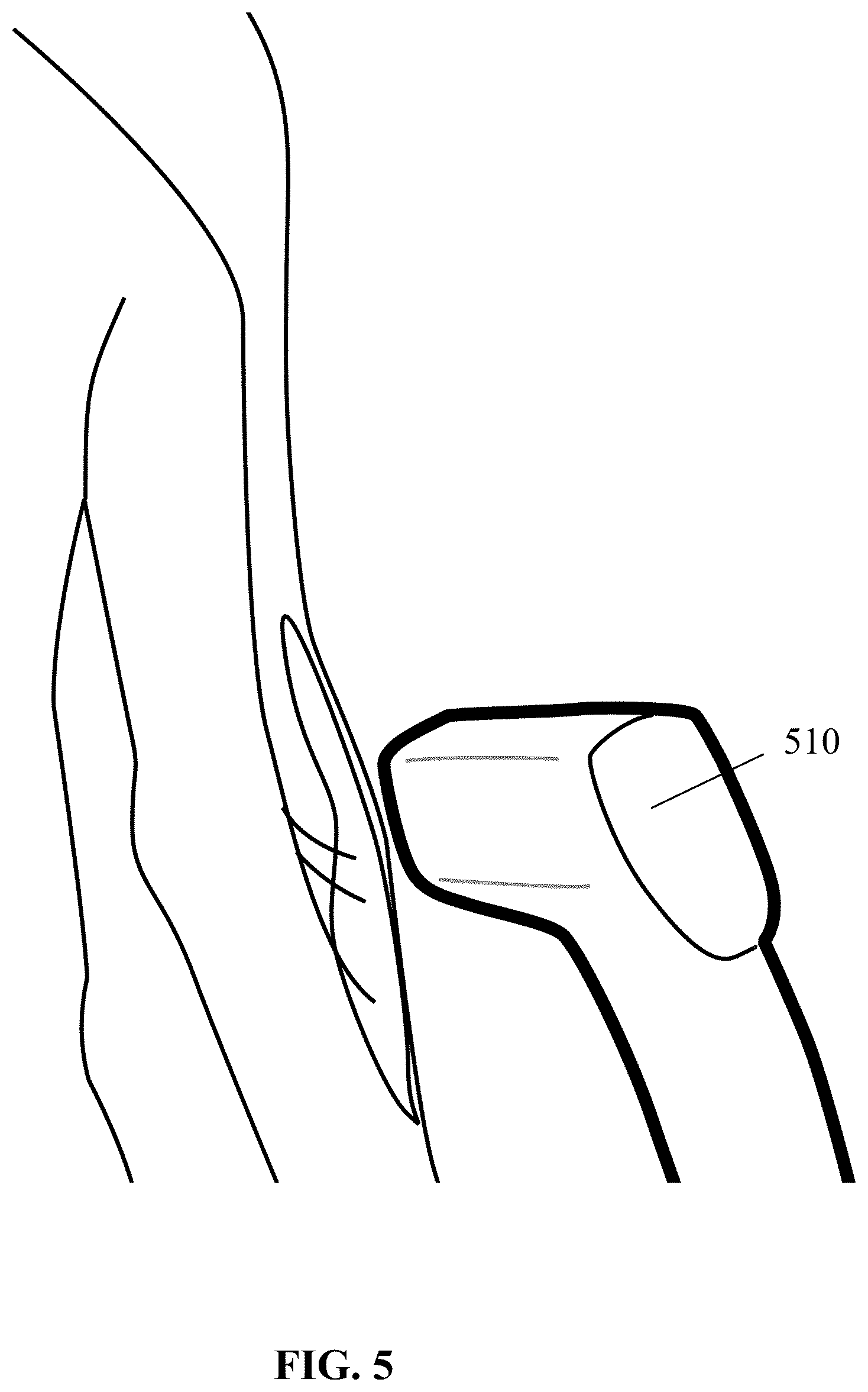 Patent US12616402 Figure 5 – Unshielded pulsed pump magnetometers for biomagnetic measurements