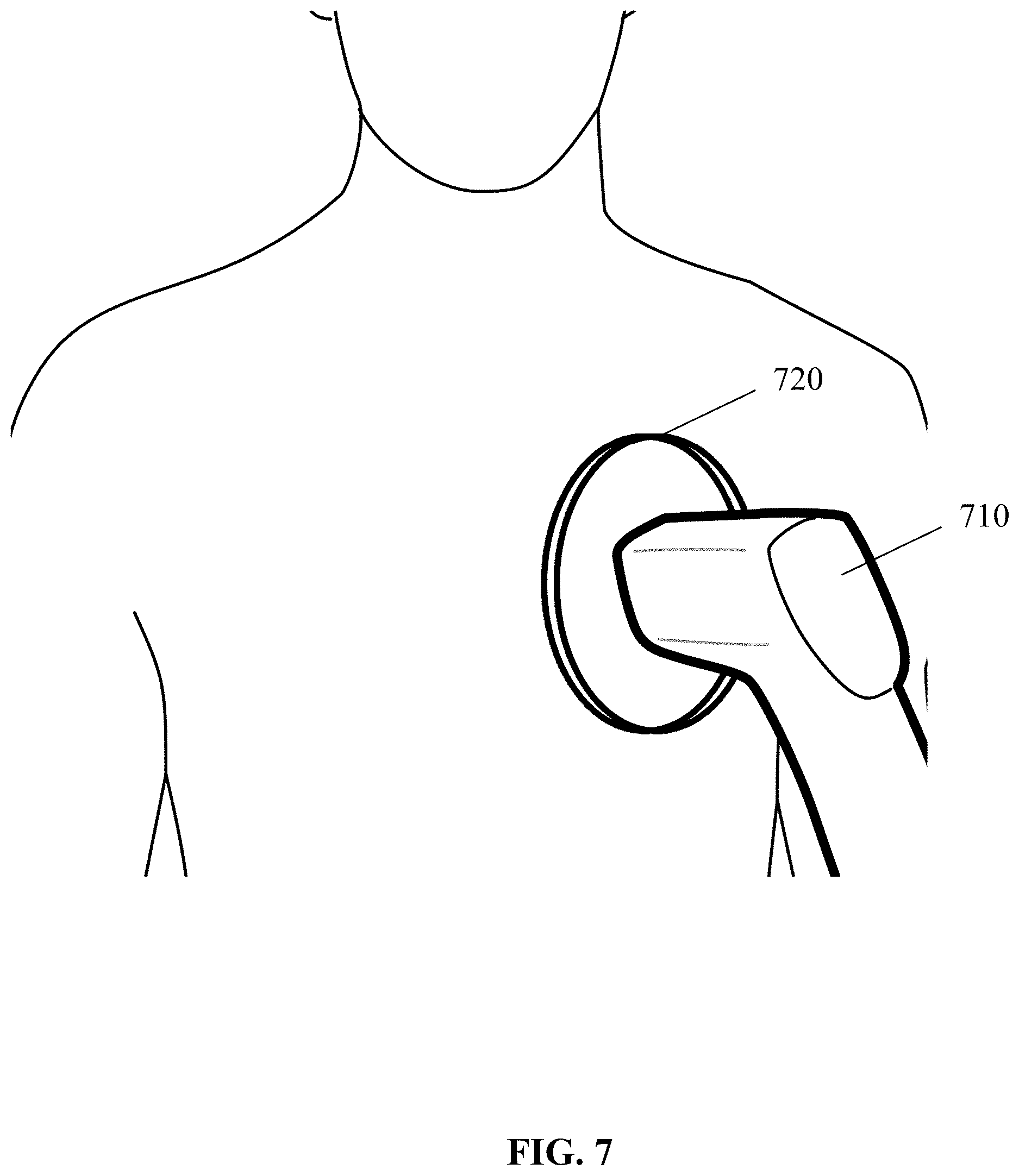 Patent US12616402 Figure 7 – Unshielded pulsed pump magnetometers for biomagnetic measurements