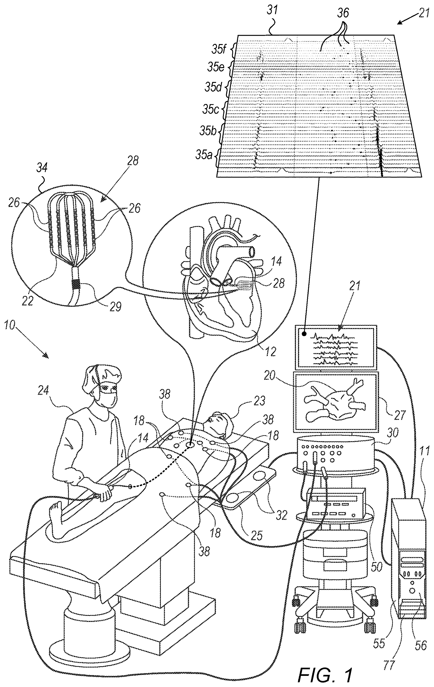 Patent US12616409 — Three-dimensional display of a multi-electrode catheter and signals acquired over time — Figure 1