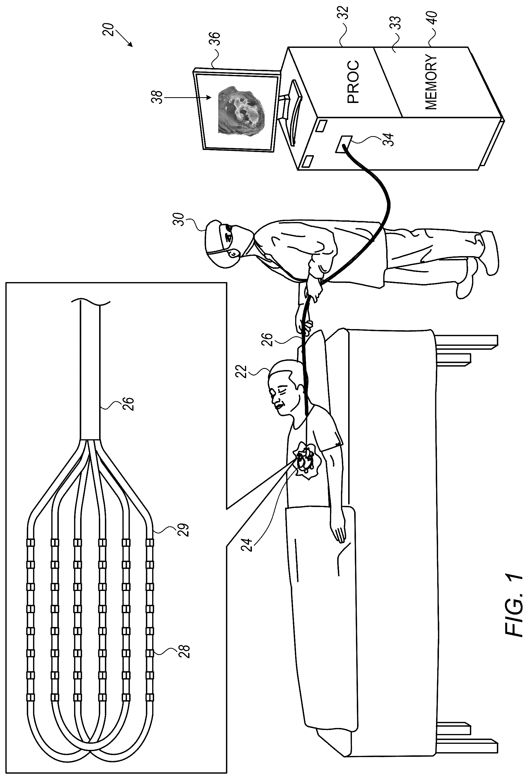 Patent US12616420 — Computing local propagation velocities for cardiac maps — Figure 1