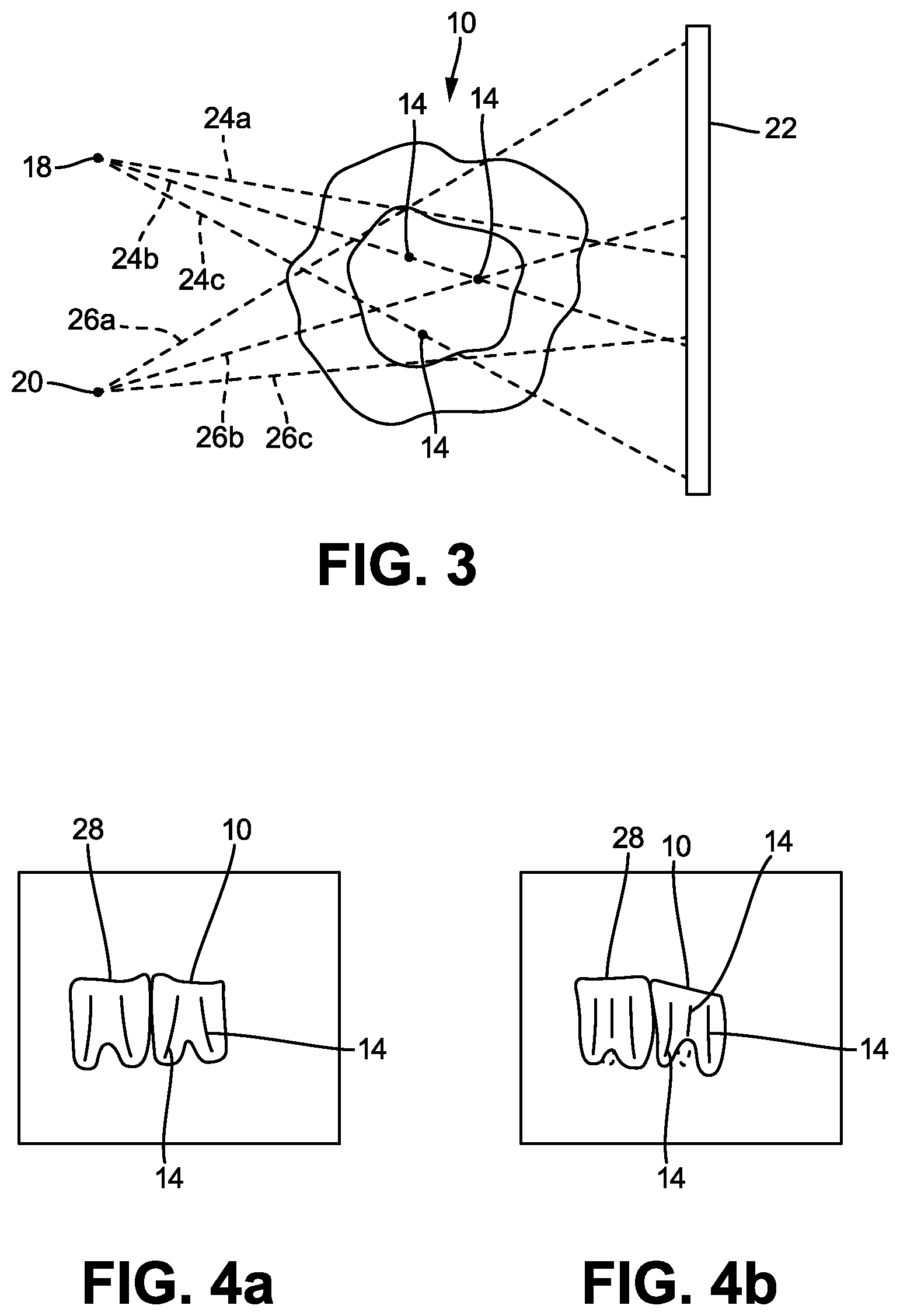 Patent US12616434 Figure 2 – Sensor holder and method for optimum positioning during intraoral imaging