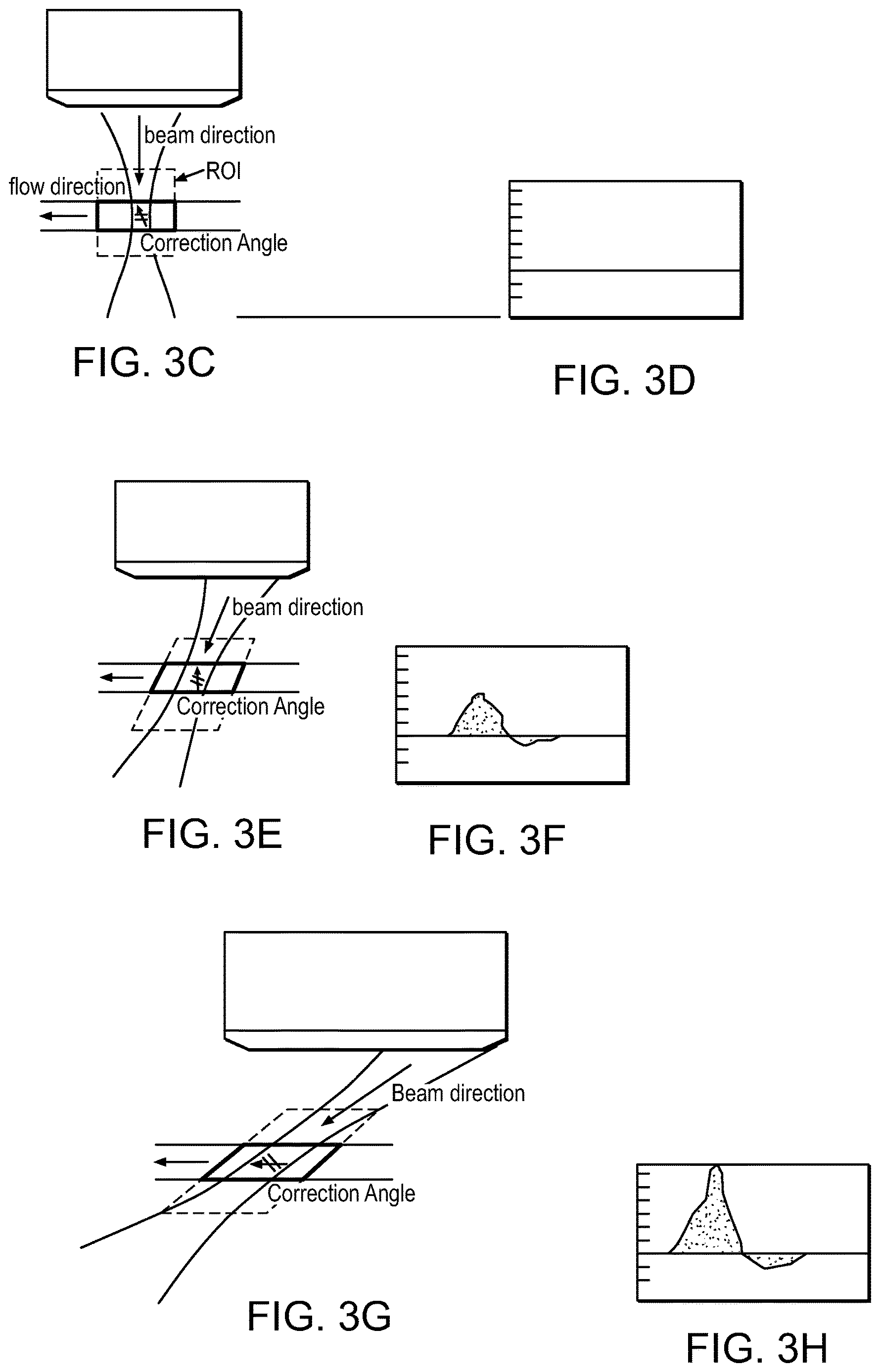 Patent US12616445 Figure 6 – Portable ultrasound system
