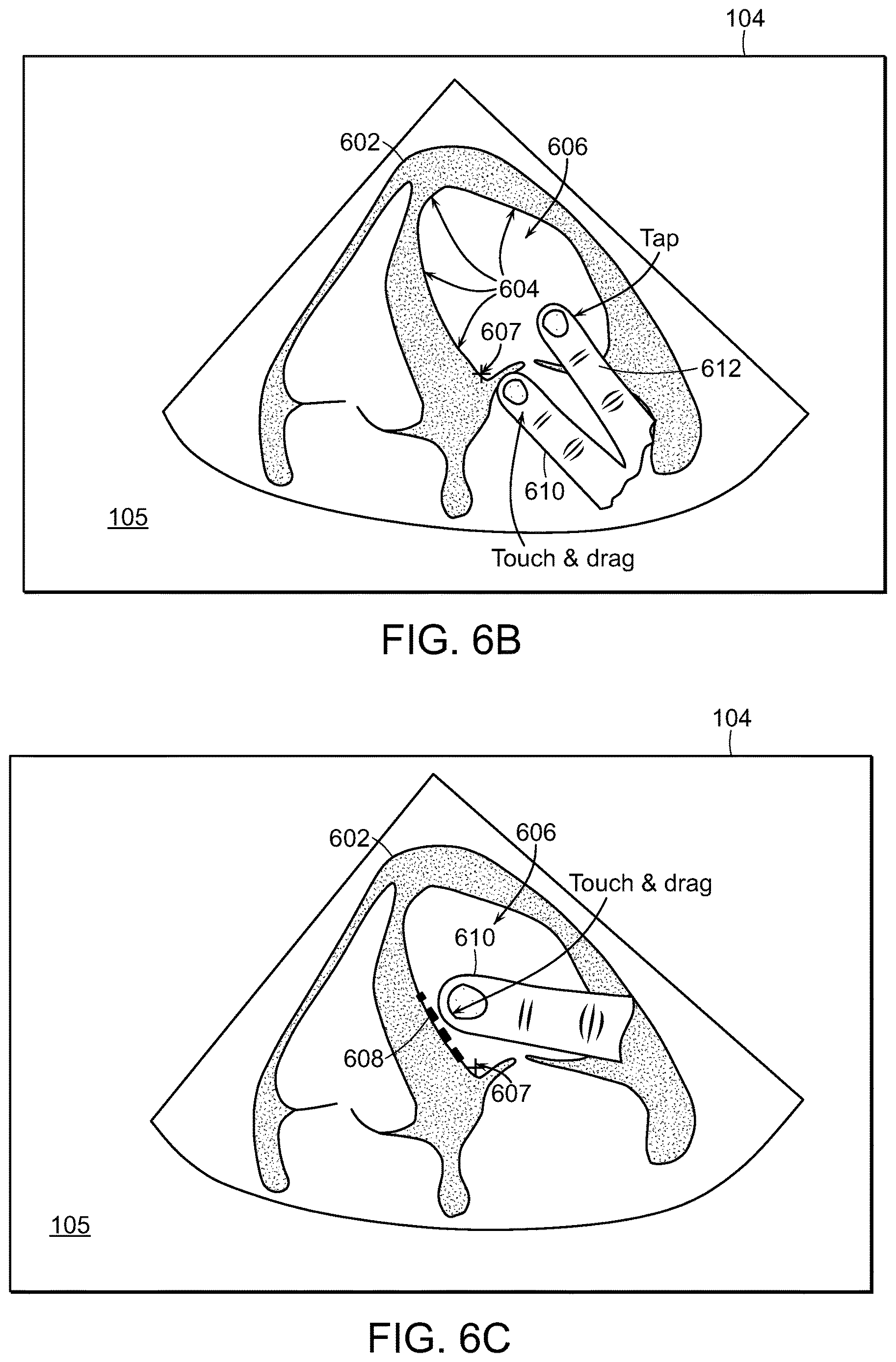 Patent US12616445 Figure 12 – Portable ultrasound system