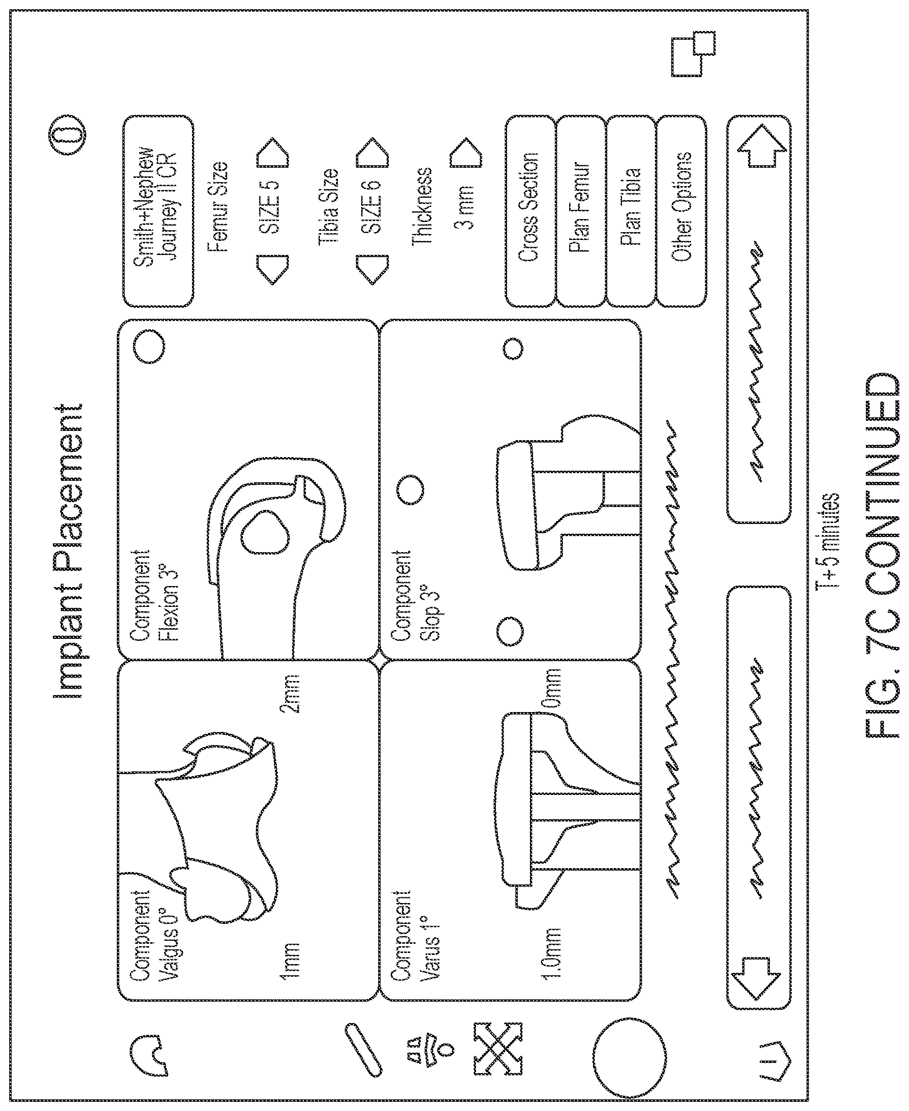 Patent US12616460 Figure 13 – Knee tensioner with digital force and displacement sensing