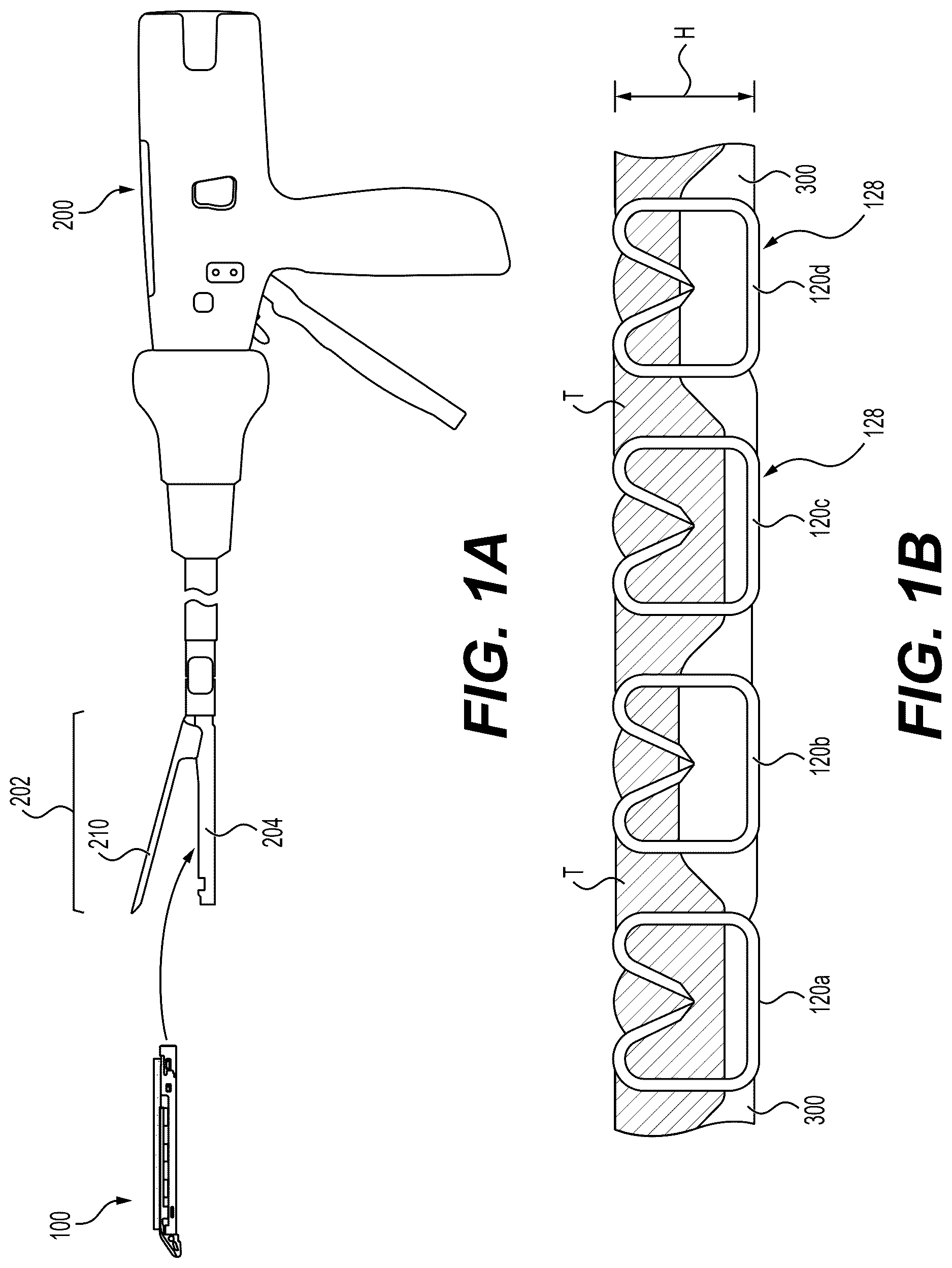 Patent US12616476 — Mechanical fixation of an implantable adjunct to a staple cartridge — Figure 1
