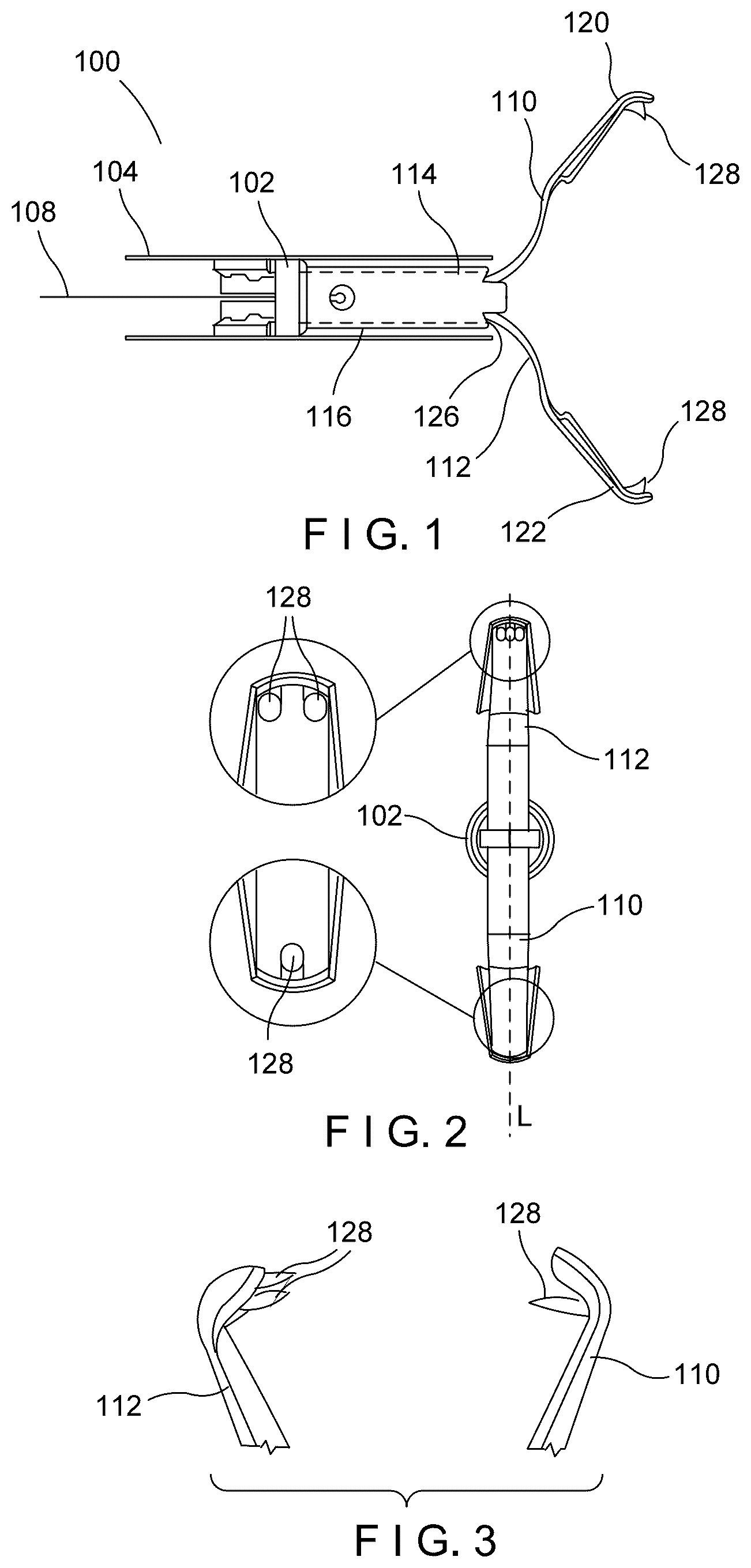 Patent US12616479 — Aggressive featured clips with improved tissue retention — Figure 1