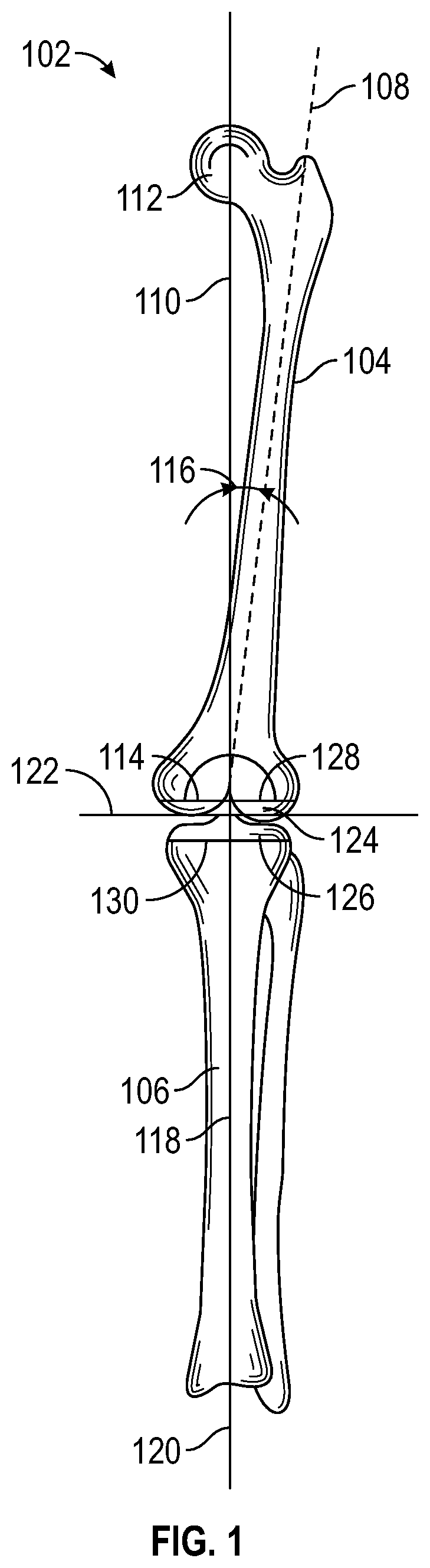 Patent US12616486 — Systems, methods, and apparatuses for tibial mechanical axis digitization — Figure 1
