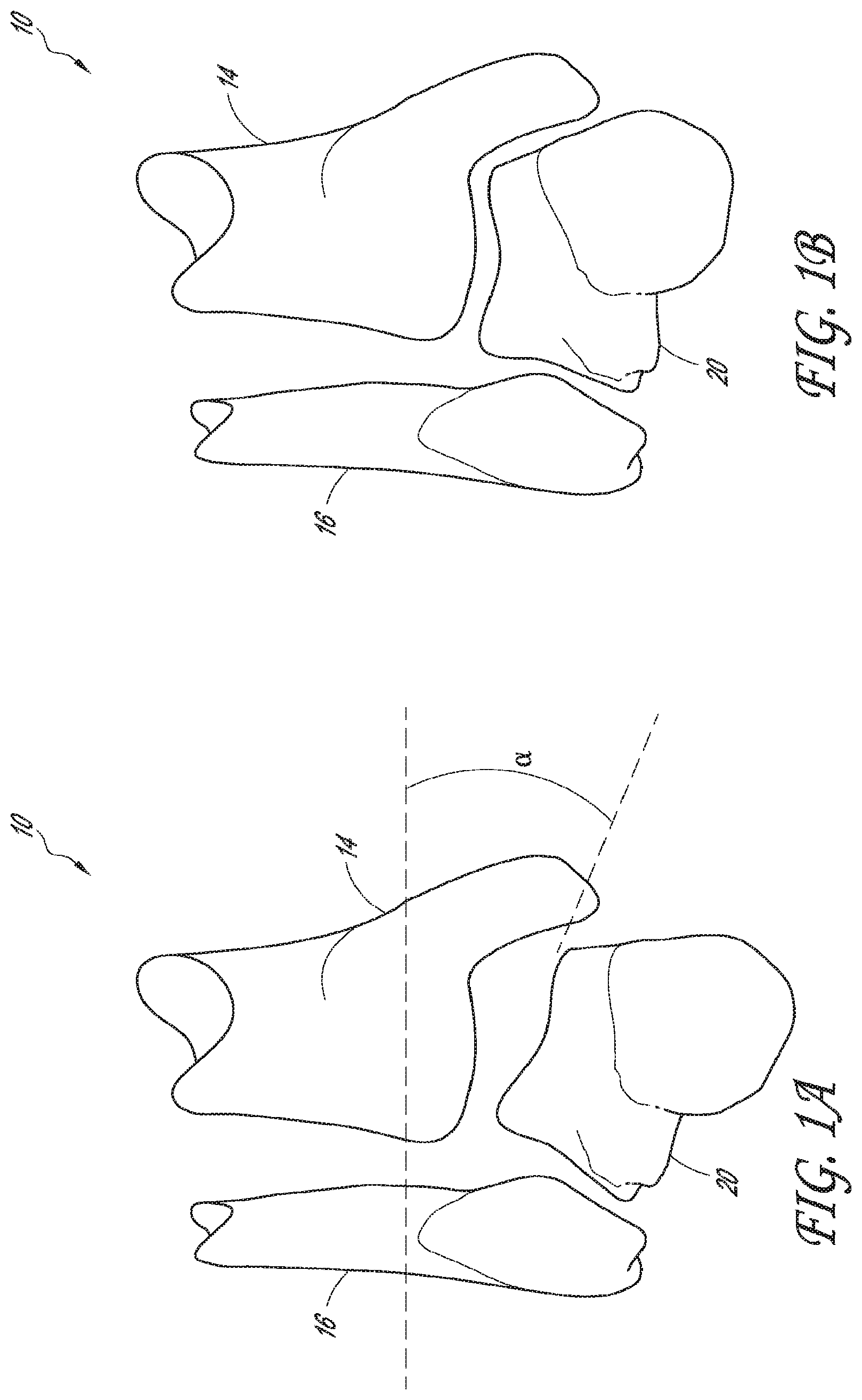 Patent US12616488 Figure 1 – Patient specific instruments and methods for joint prosthesis