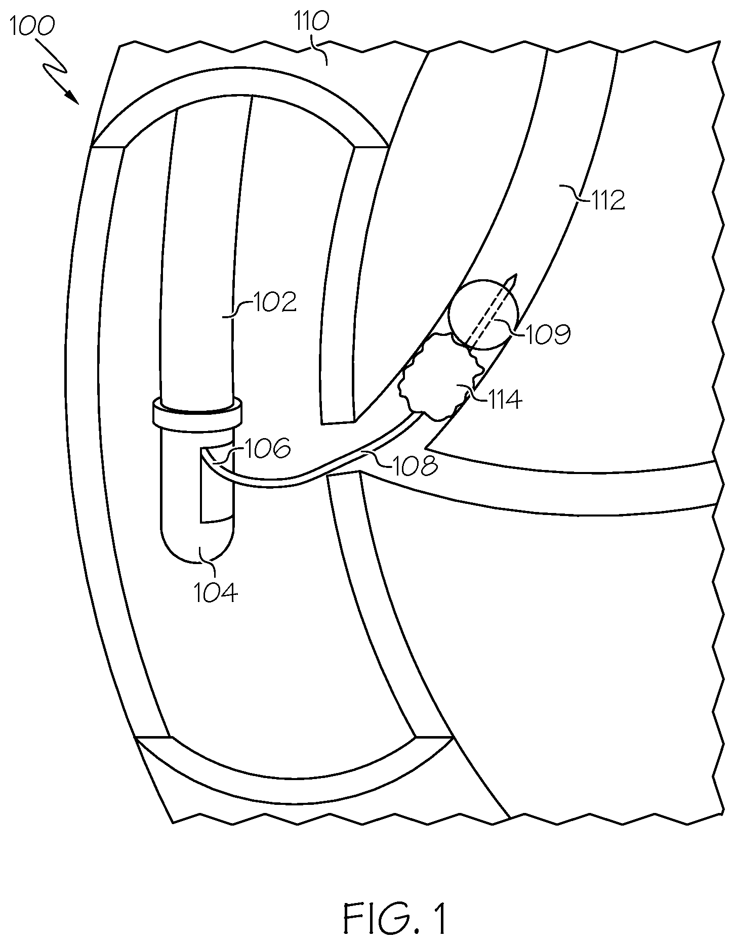 Patent US12616491 — Medical devices and related methods thereof — Figure 1