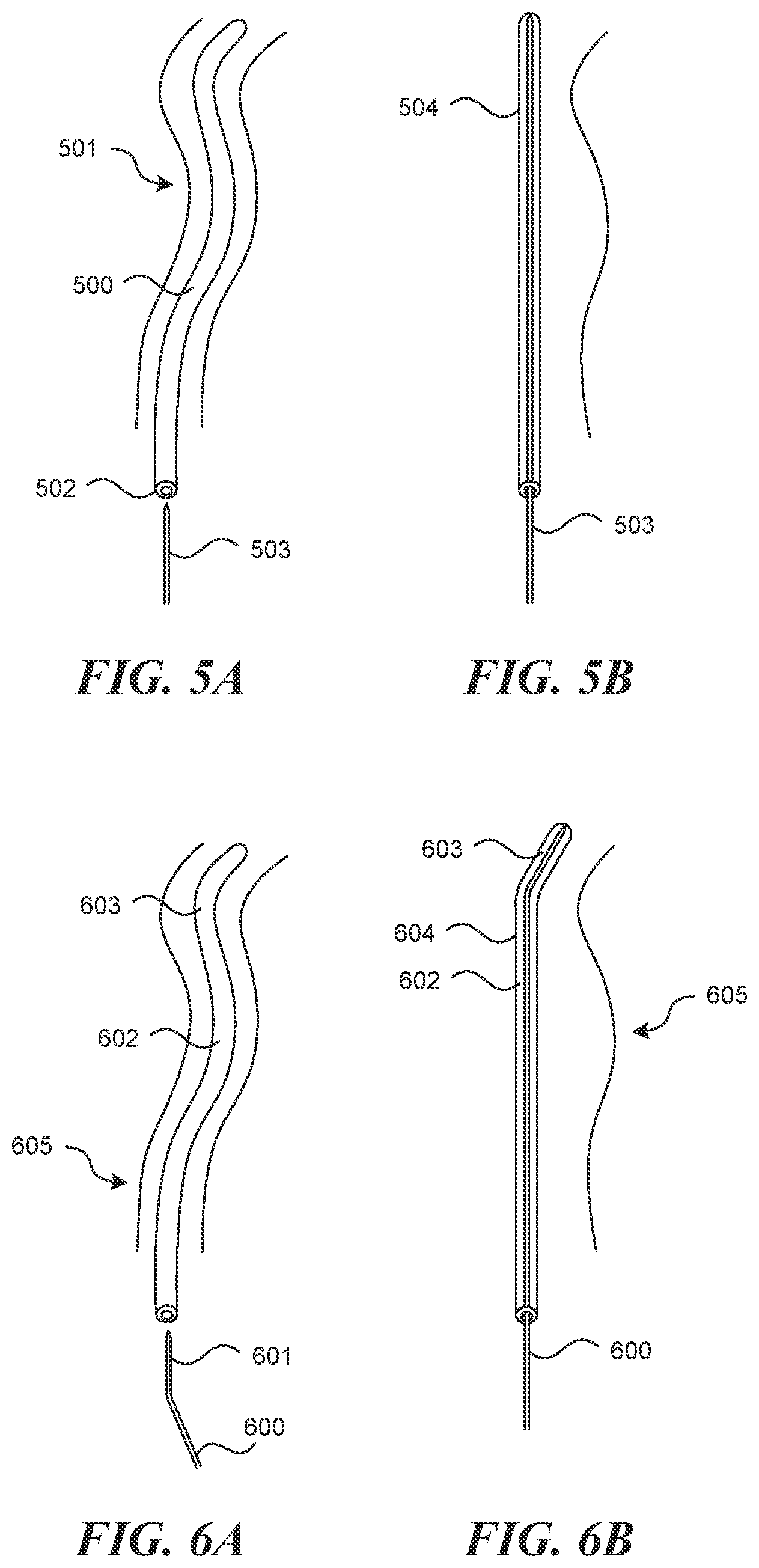 Patent US12616499 Figure 5 – Systems and methods for endoluminal valve creation