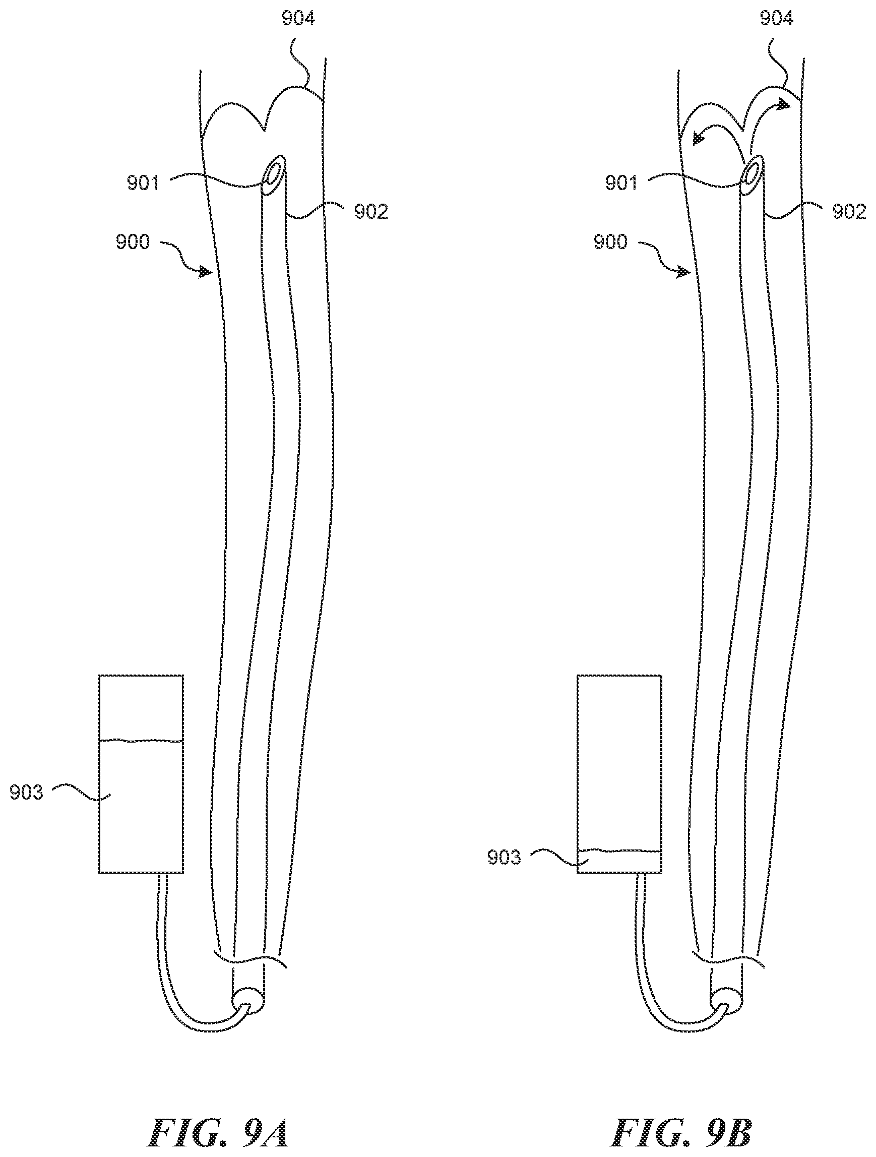 Patent US12616499 Figure 8 – Systems and methods for endoluminal valve creation