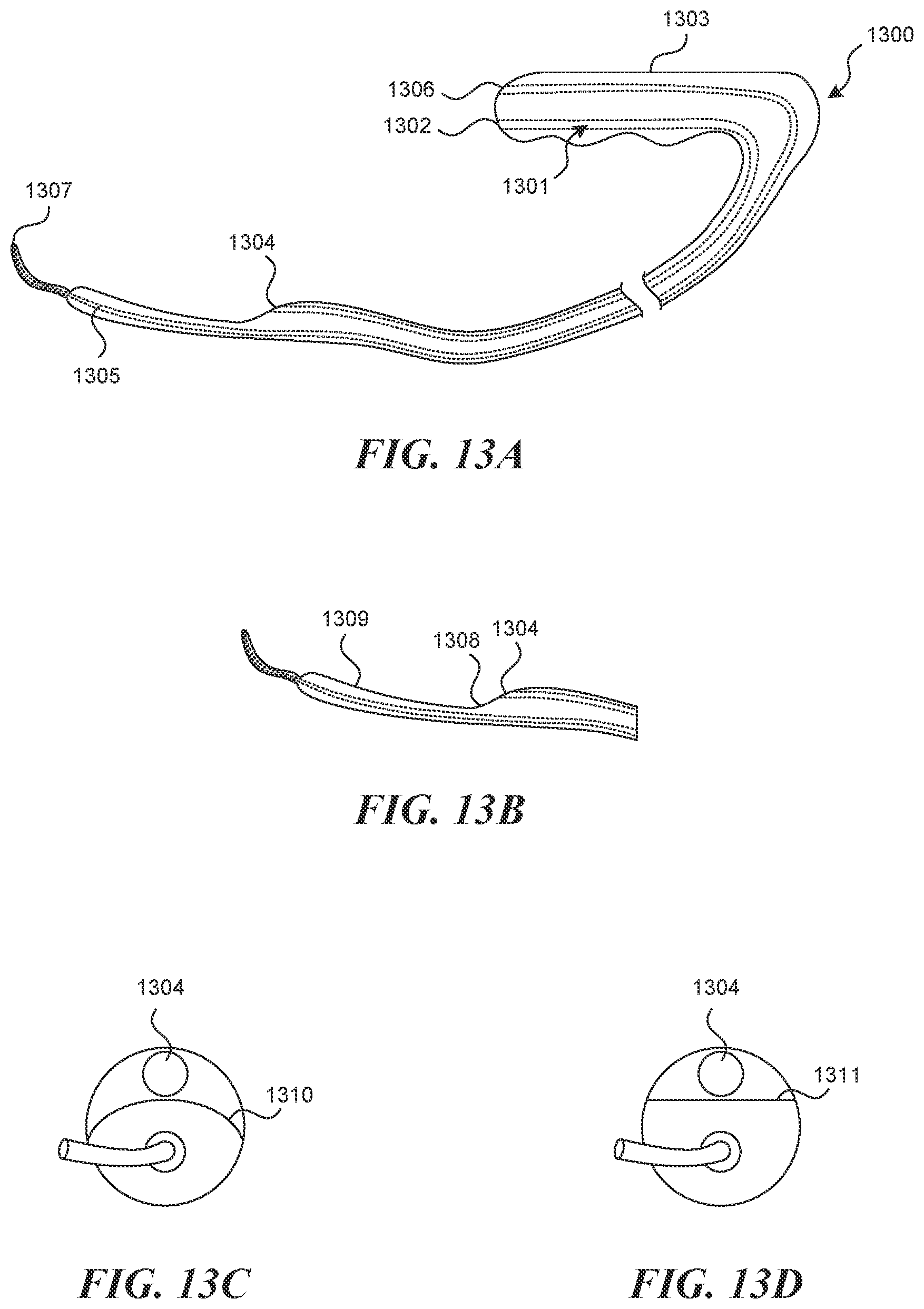 Patent US12616499 Figure 11 – Systems and methods for endoluminal valve creation