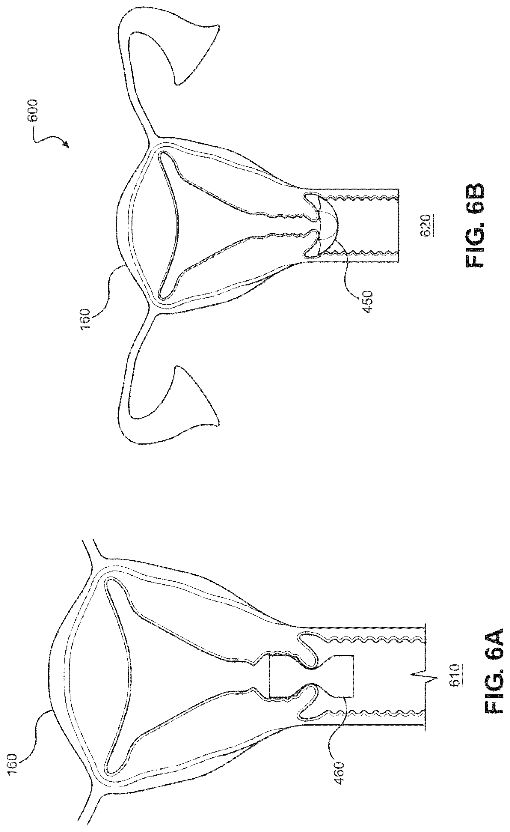 Patent US12616503 Figure 6 – Methods for postpartum uterine hemostasis
