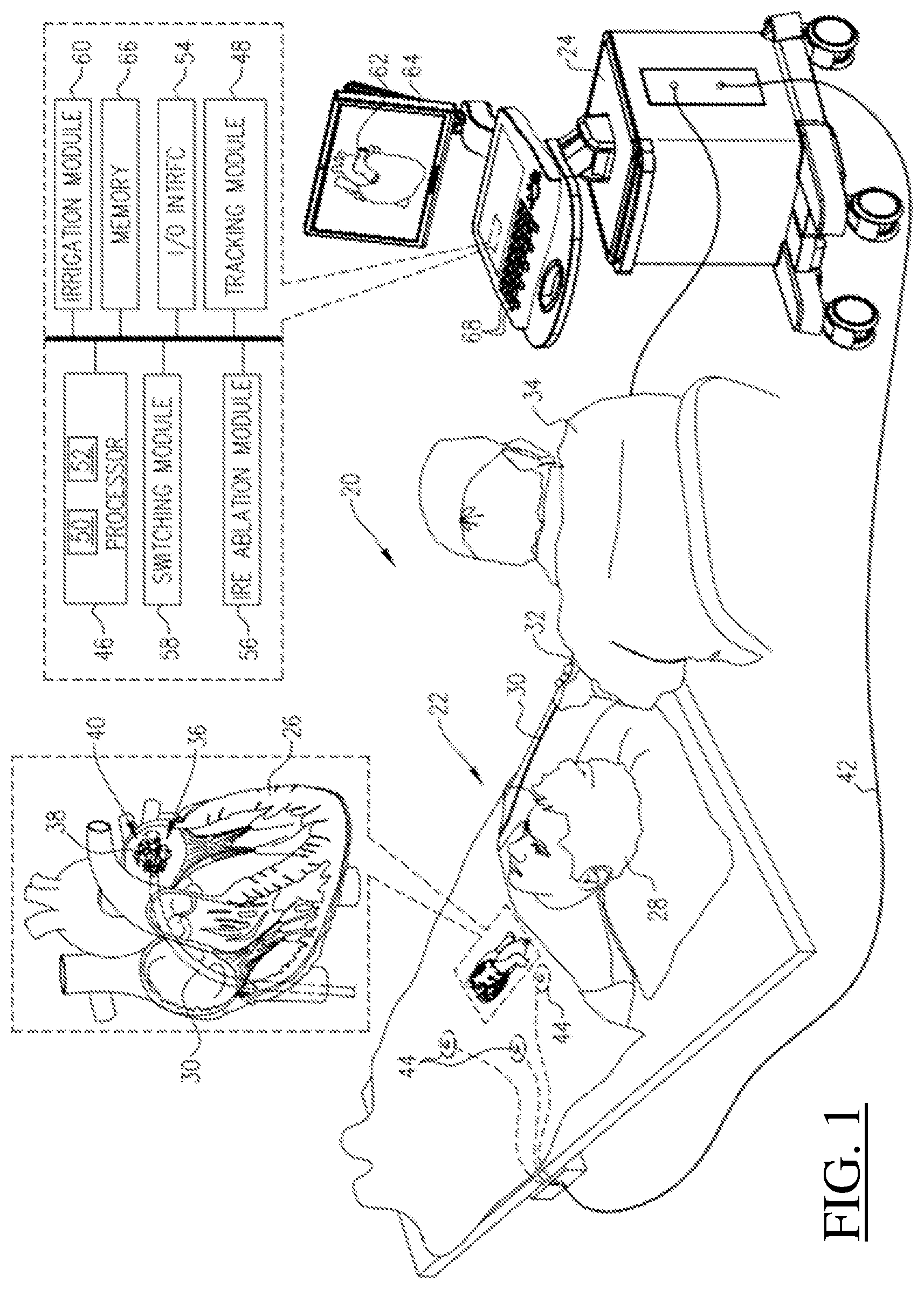 Patent US12616518 — Barrel electrodes for a basket catheter, and methods of the same — Figure 1