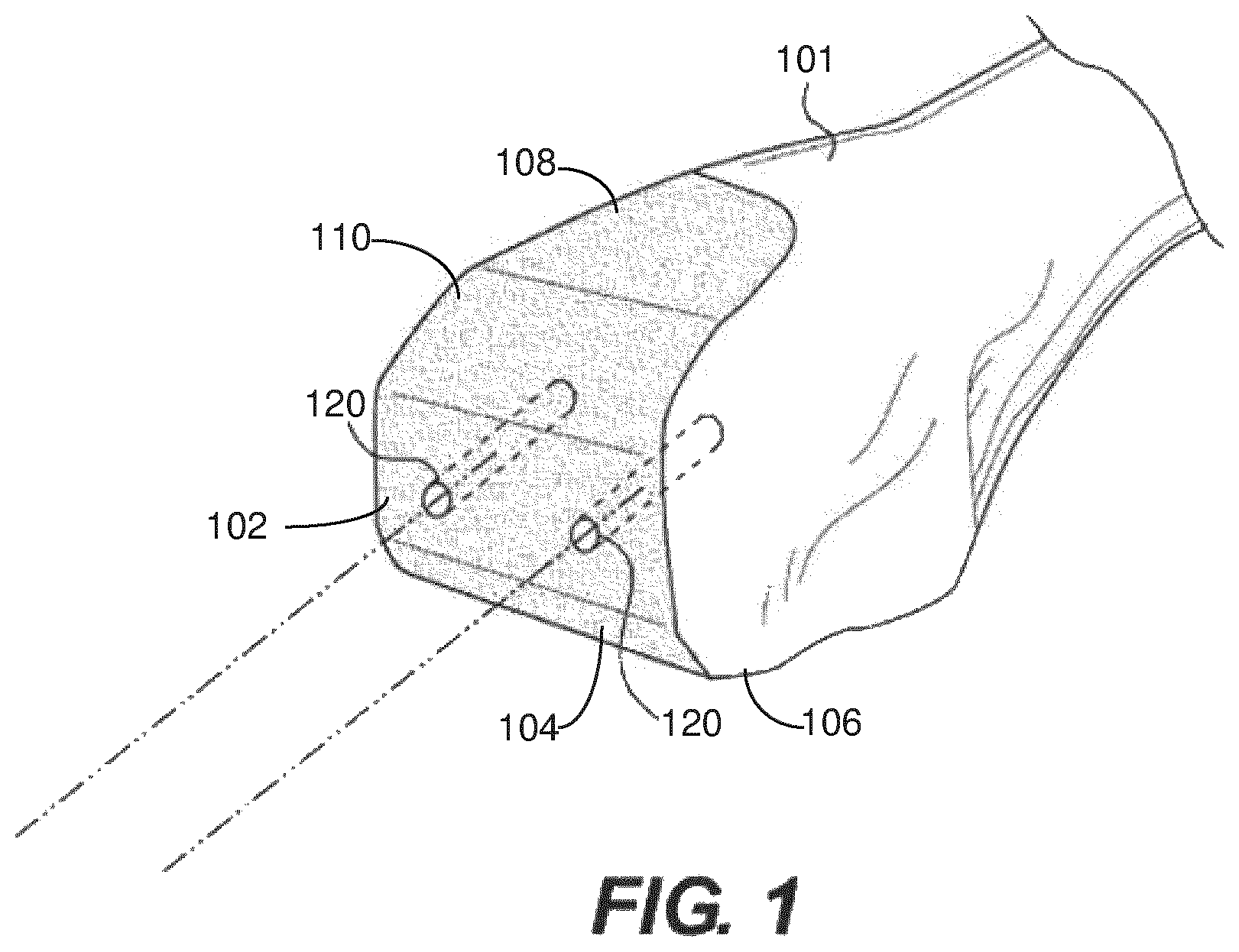Patent US12616523 — Surgeon preferences and warning visualizations for implant planning — Figure 1