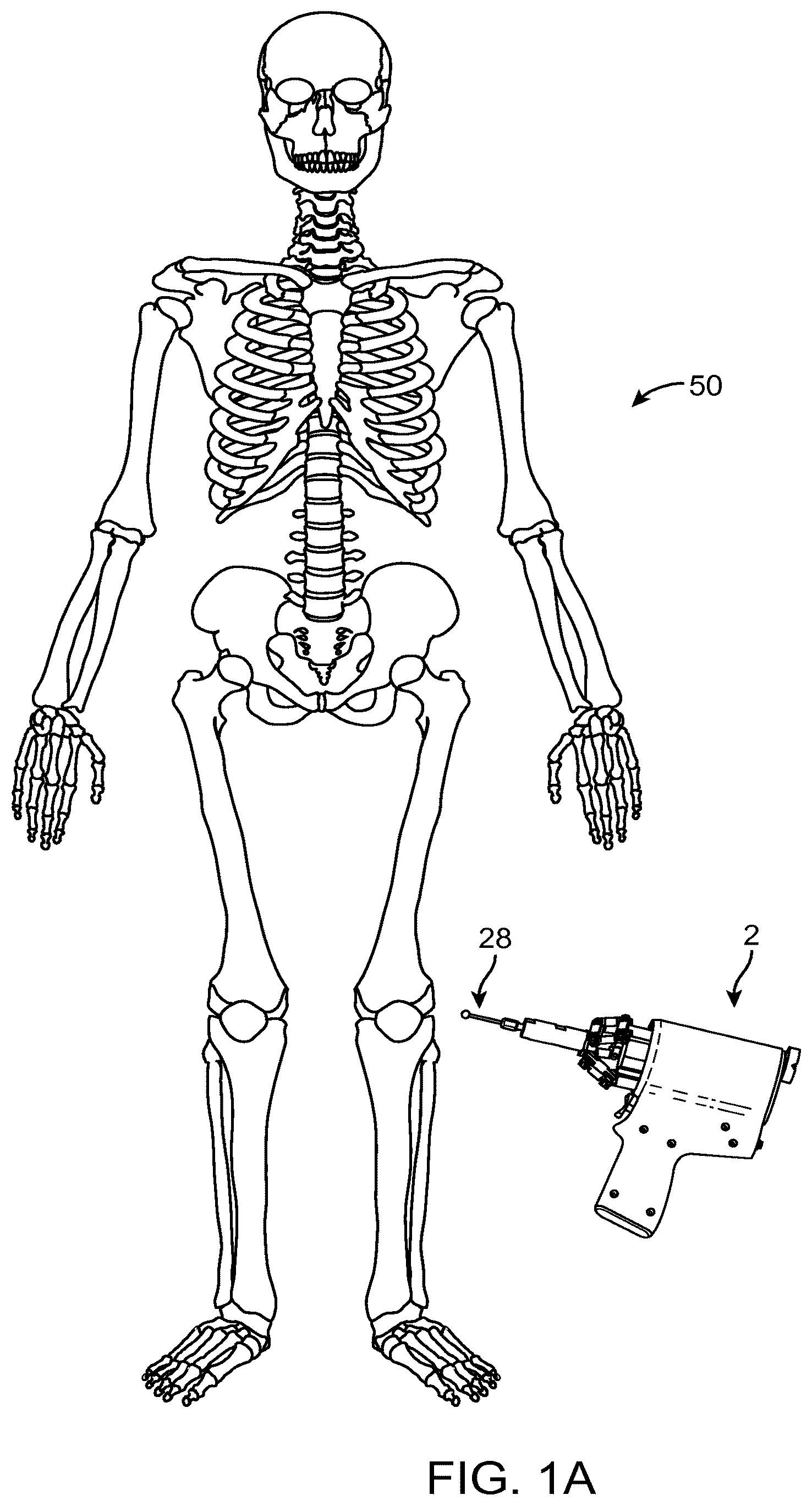 Patent US12616535 — Systems and methods for handheld robotic surgery — Figure 1