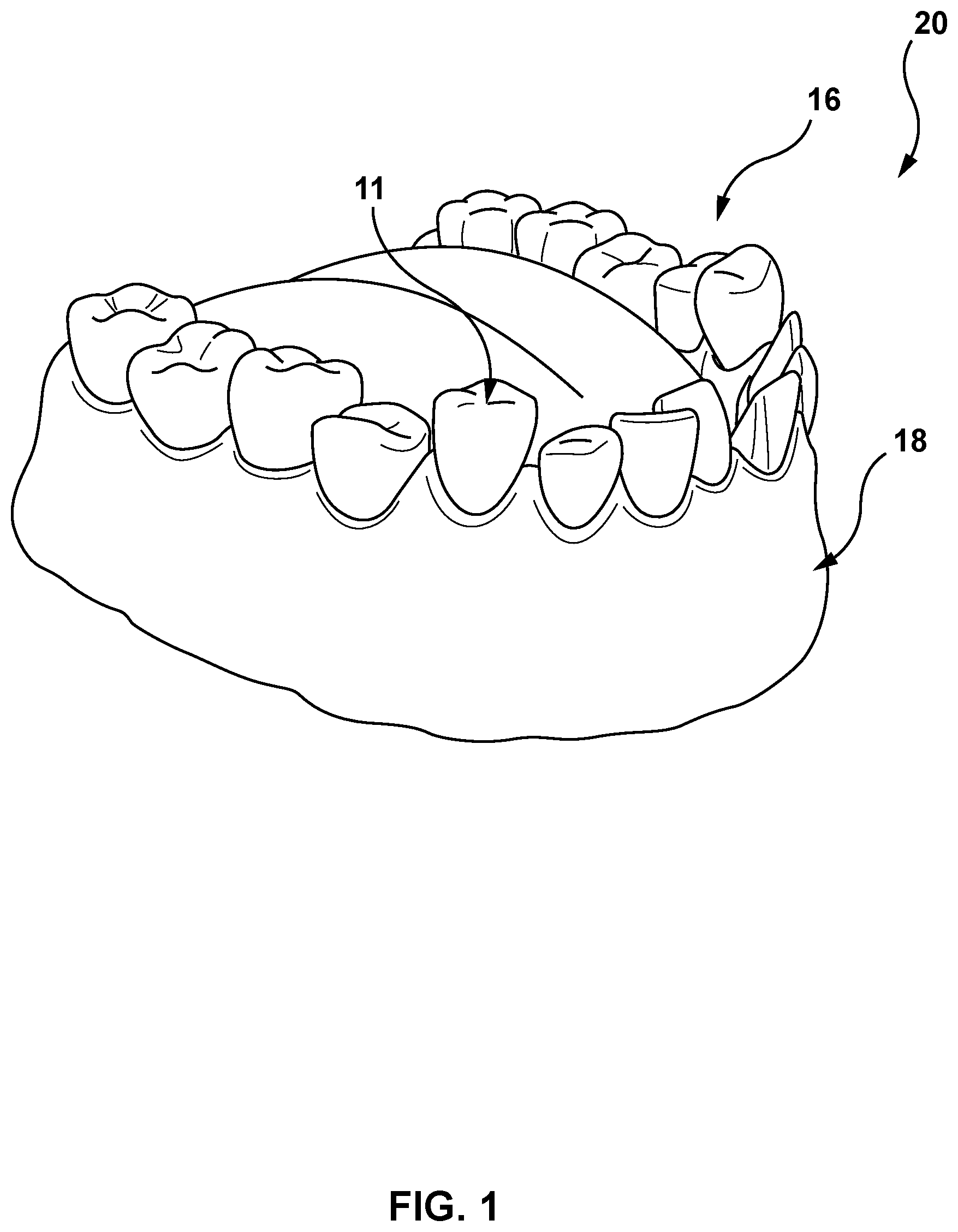 Patent US12616557 — Systems and methods for determining an edge of orthodontic appliances — Figure 1