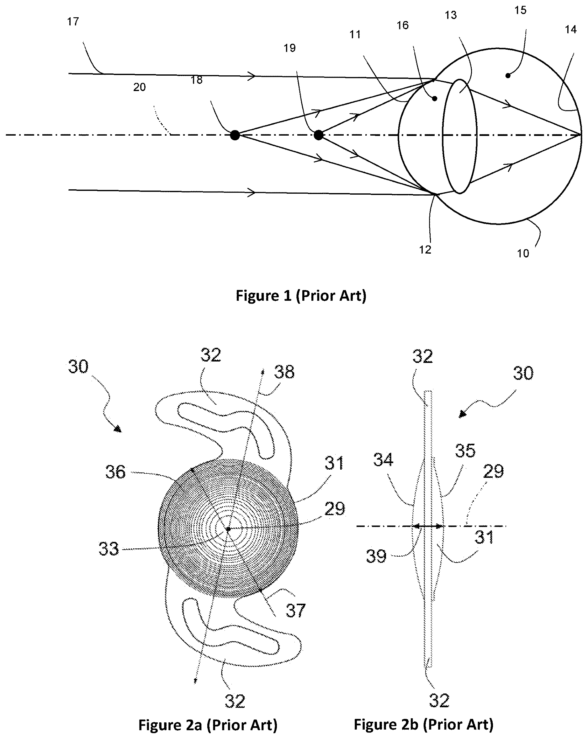 Patent US12616566 Figure 1 – Adaptive multifocal diffractive ocular lens