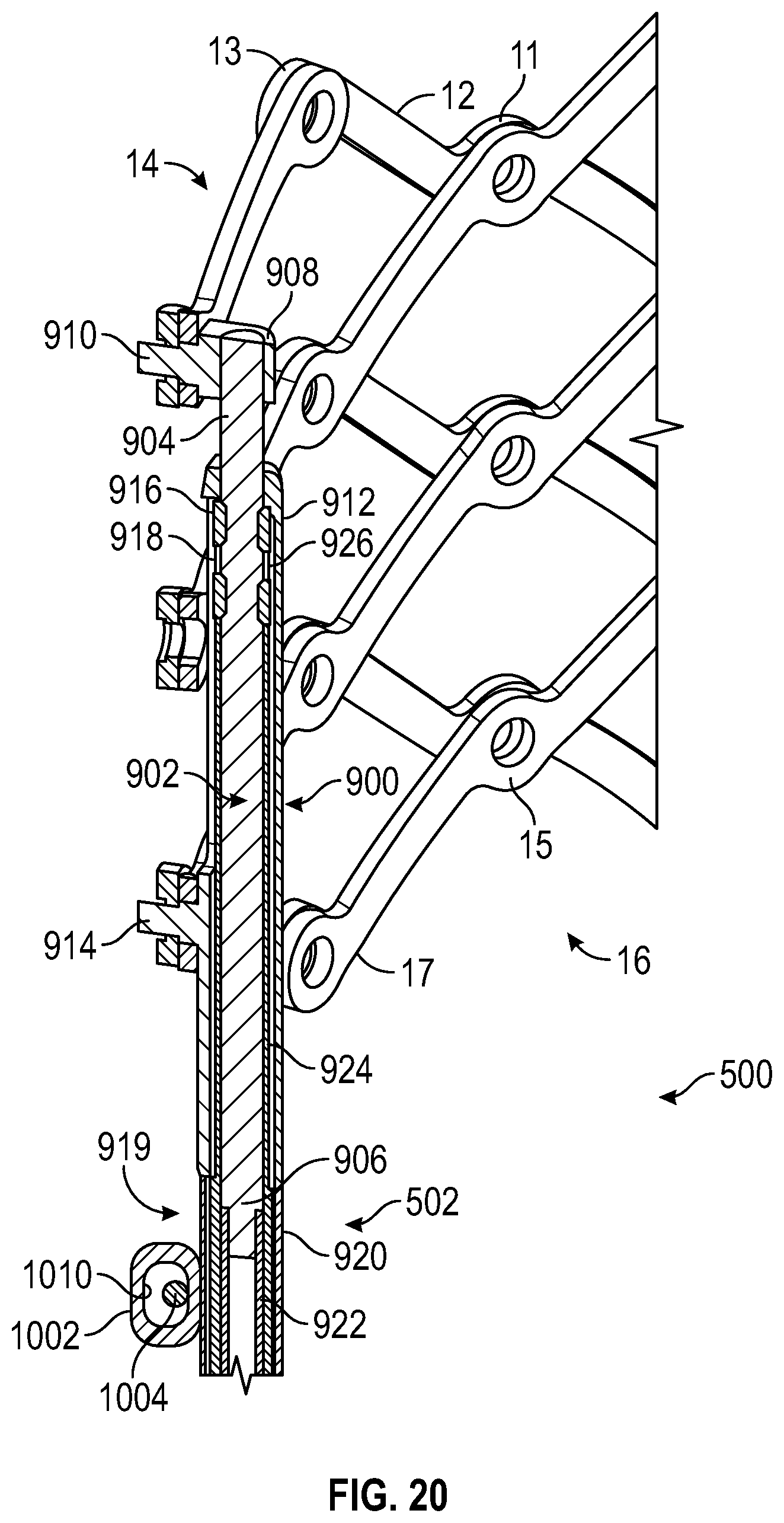 Patent US12616569 Figure 17 – Prosthetic heart valve having non-cylindrical frame