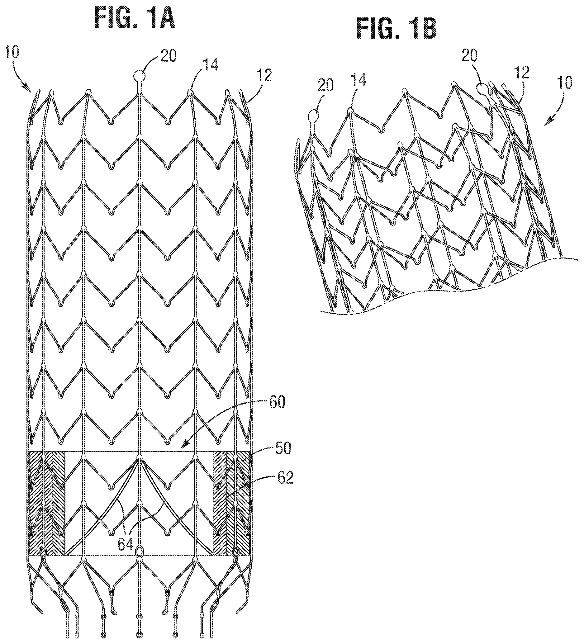 Patent US12616571 — Implantable frame and frame retaining mechanism — Figure 1