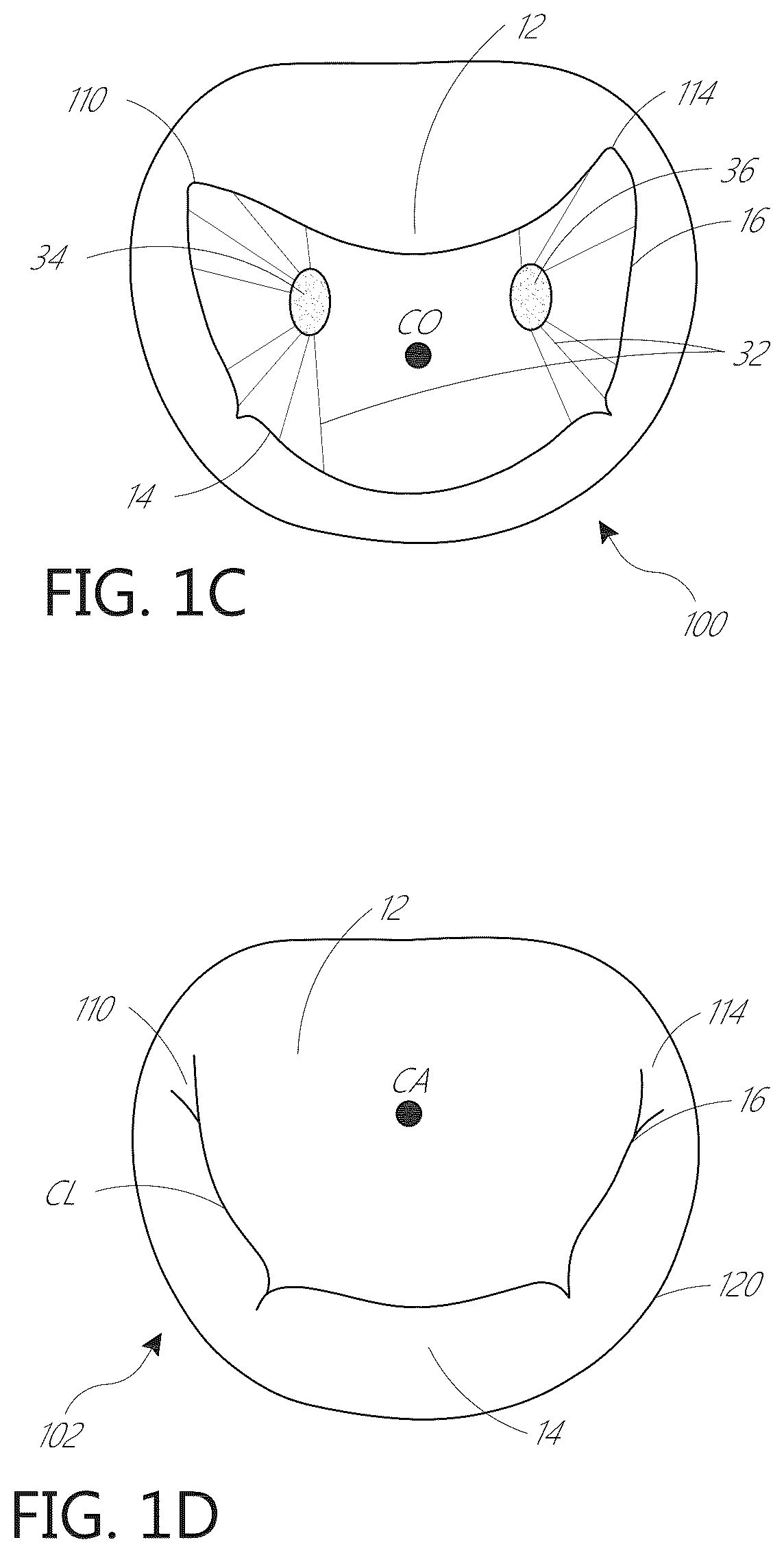 Patent US12616574 Figure 2 – Device, system, and method for transcatheter treatment of valvular regurgitation